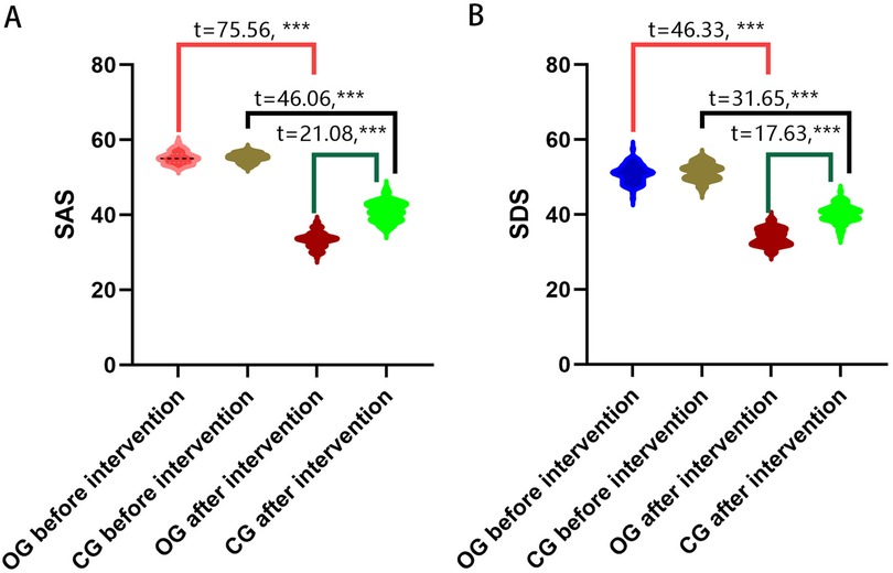 Violin plots comparing scores before and after intervention. Panel A shows SAS scores with significant differences: OG before vs. after (t=75.56), CG before vs. OG after (t=46.06), and CG before vs. after (t=21.08). Panel B displays SDS scores with significant differences: OG before vs. after (t=46.33), CG before vs. OG after (t=31.65), and CG before vs. after (t=17.63). Each comparison is marked with *** indicating significance.