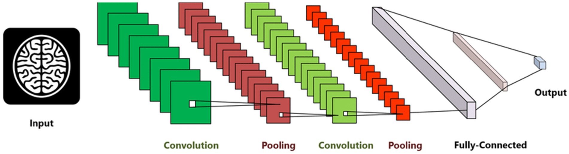 Diagram of a Convolutional Neural Network (CNN) architecture. Shows the flow from input brain image to convolution layers, pooling layers, fully connected layers, and final output. Highlights how CNN processes MRI images to classify dementia stages.