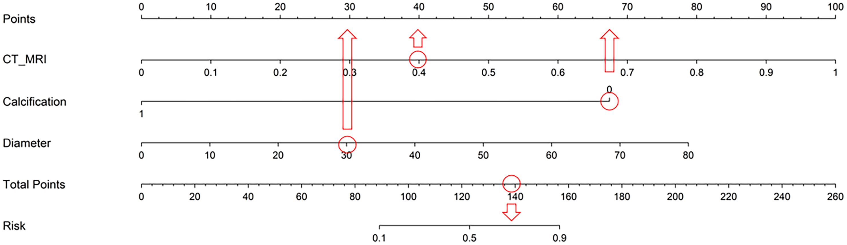 A nomogram displays a predictive model with scales for Points, CT_MRI, Calcification, Diameter, Total Points, and Risk. Red arrows and circles indicate example values at CT_MRI 0.4, Calcification 0, Diameter 30, and Total Points 140, corresponding to a risk near 0.2.