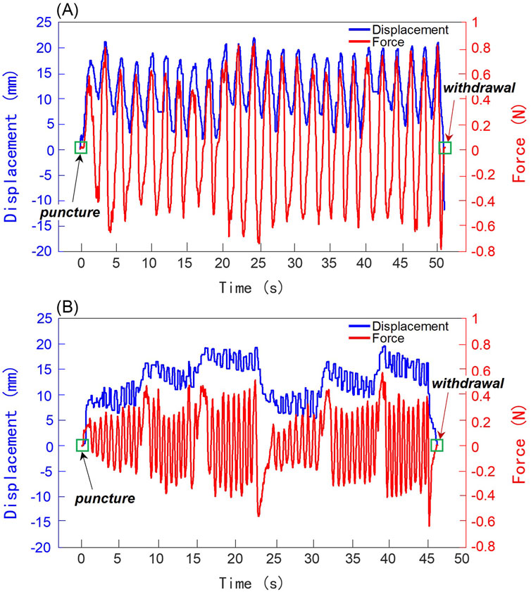 Graph depicting two panels, A and B. Both show displacement in millimeters and force in newtons over time in seconds. Panel A displays a consistent sinusoidal pattern, while Panel B shows an irregular pattern with varying peaks. Both graphs have annotations indicating