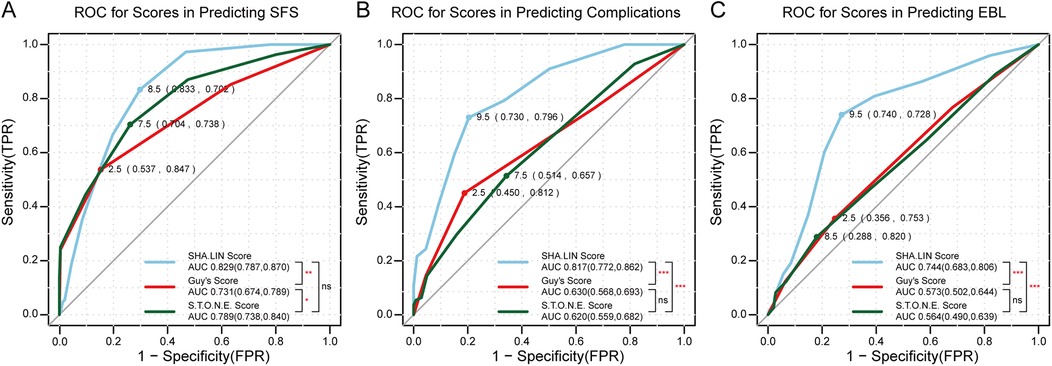 Three ROC curves compare scores in predicting outcomes. Graph A: predicting SFS, showing SHA.LIN (AUC 0.829), Guy’s (AUC 0.731), and S.T.O.N.E (AUC 0.789) scores. Graph B: predicting complications, with SHA.LIN (AUC 0.817), Guy’s (AUC 0.630), S.T.O.N.E (AUC 0.620). Graph C: predicting EBL, showing SHA.LIN (AUC 0.744), Guy’s (AUC 0.573), S.T.O.N.E (AUC 0.564). SHA.LIN scores generally outperform others.