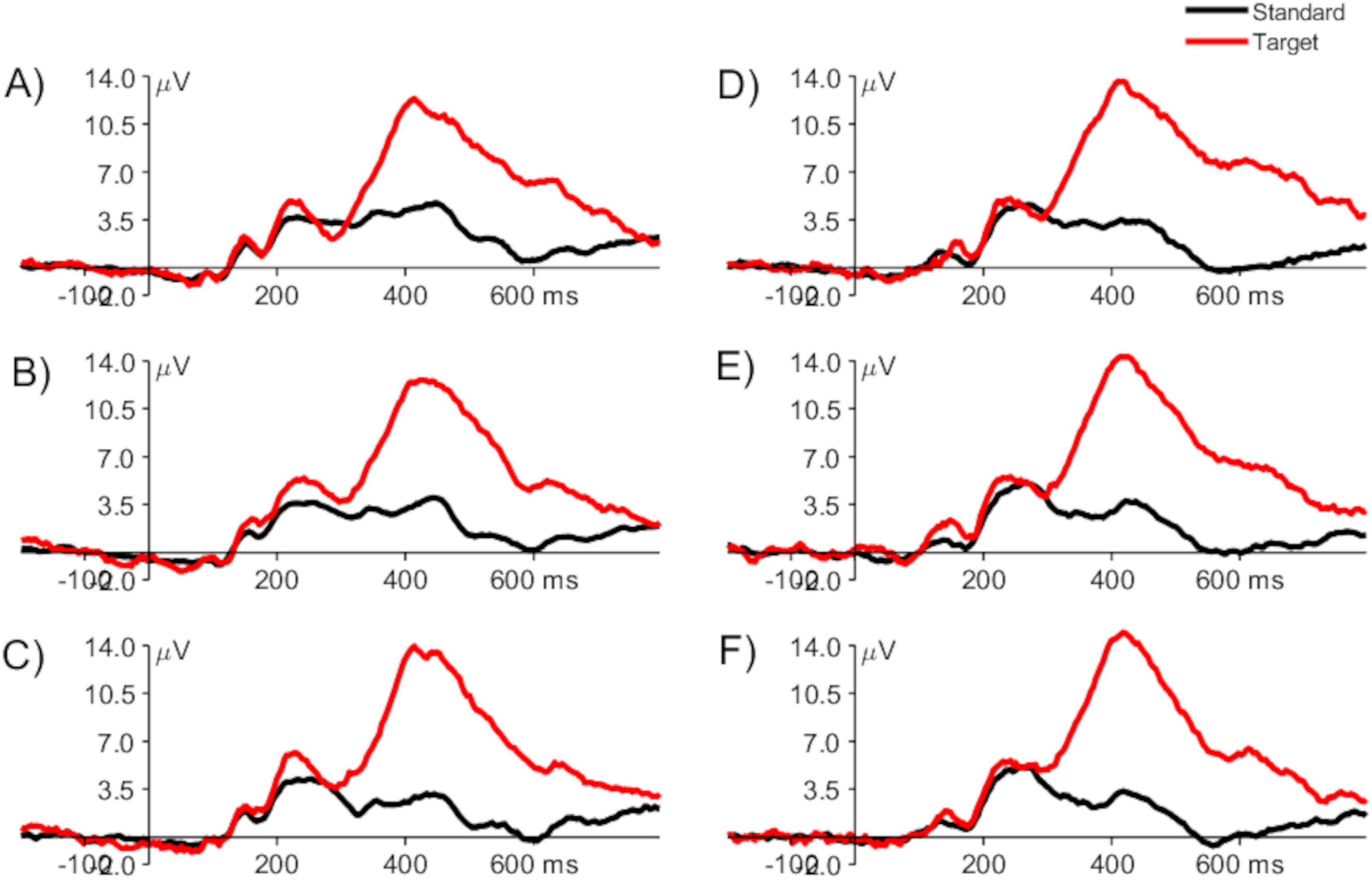 Six line graphs labeled A to F display electrical activity over time in microvolts. Each graph features two lines: red for “Target” and black for “Standard.” The red line shows higher peaks, especially between 300 and 500 milliseconds, compared to the black line, which stays relatively flat.