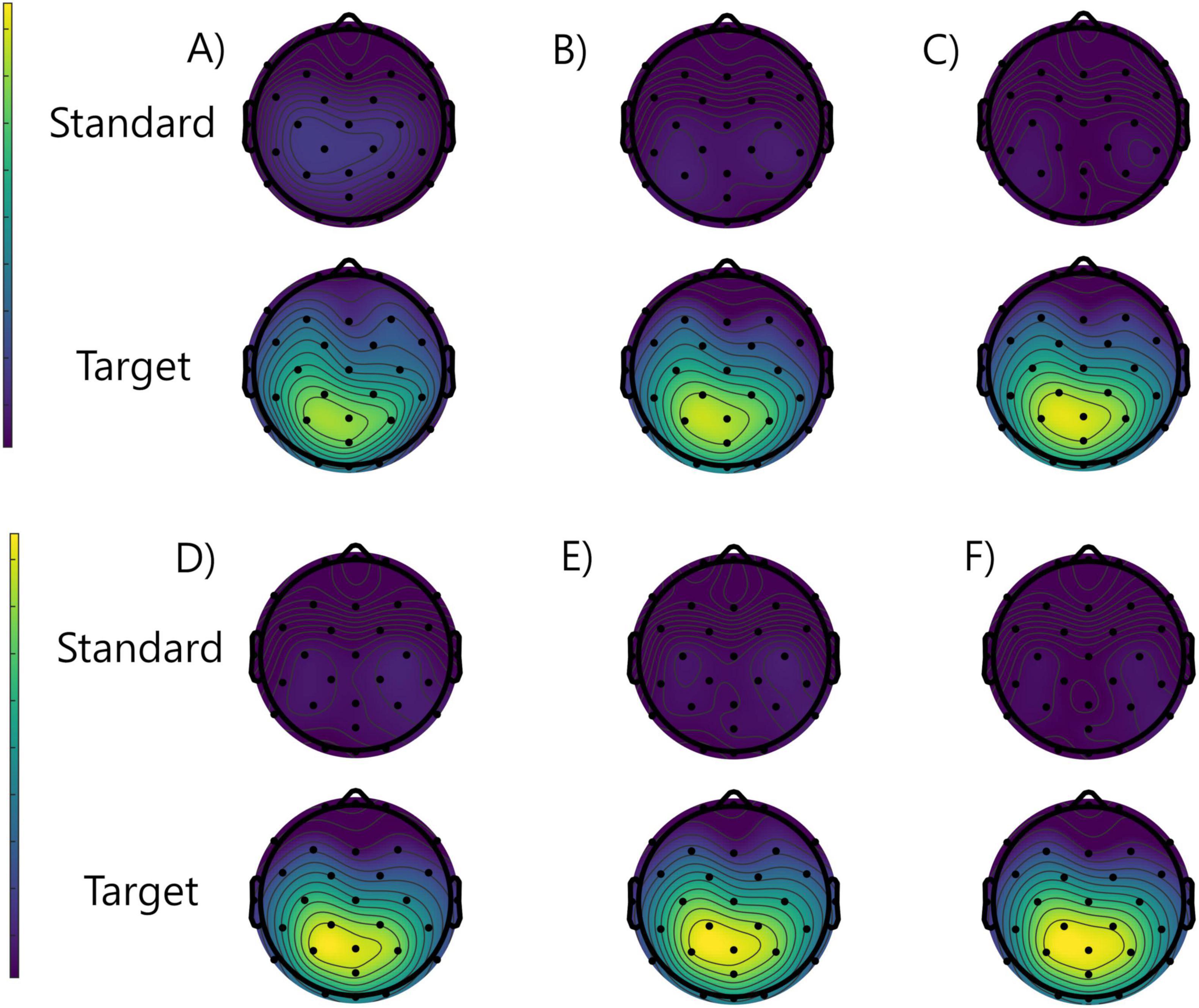 Six numbered topographic maps, labeled A to F, display brain activity. Each map has a “Standard” and “Target” condition. “Standard” maps are predominantly purple, indicating lower activity, while “Target” maps show gradients transitioning to yellow at the center, indicating higher activity. A scale on the left ranges from purple (low) to yellow (high).