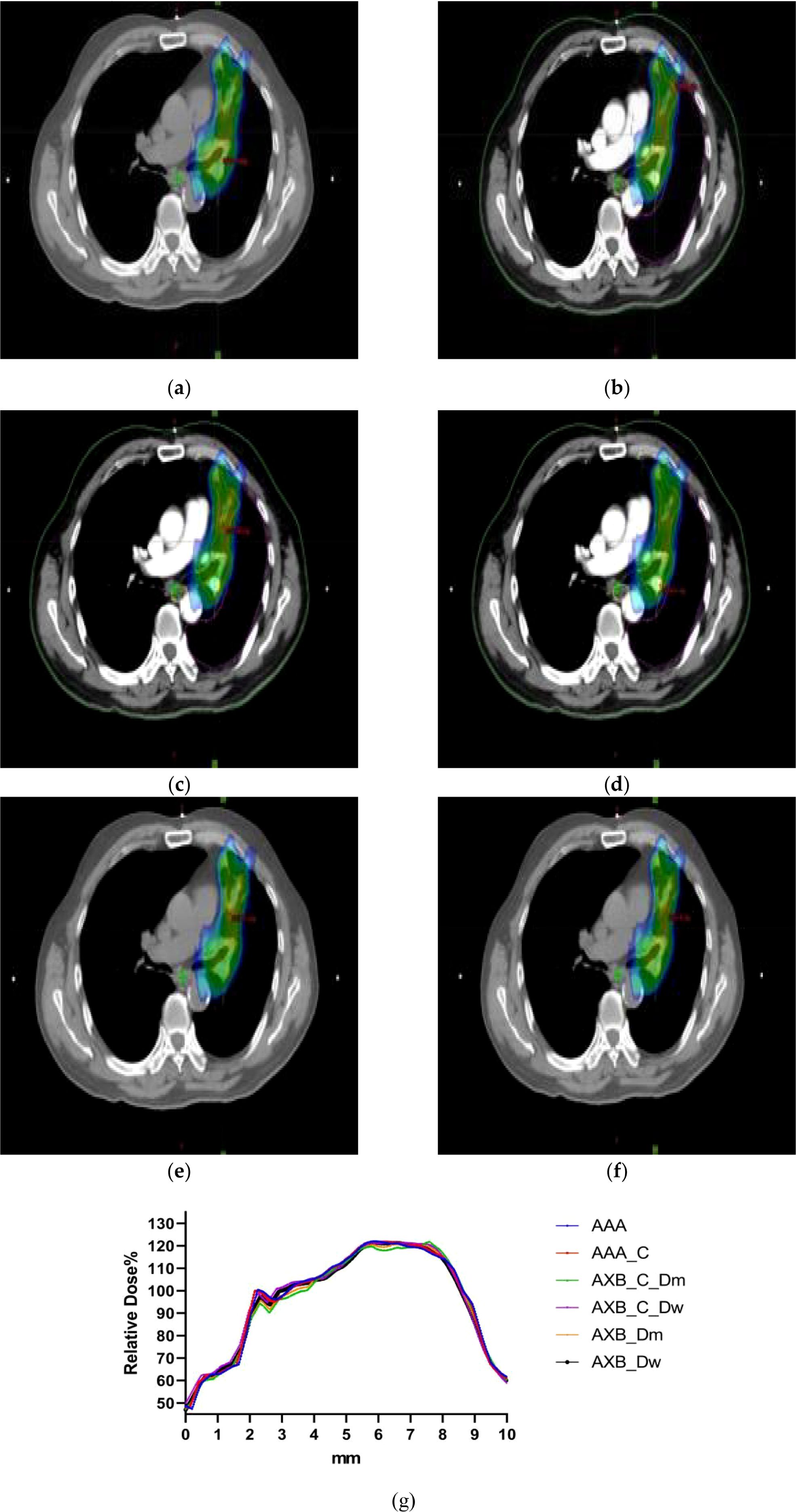 CT scan images (a-f) show cross-sections of the chest with colored overlays indicating treatment areas. Image (g) is a graph illustrating different dose distributions, with doses on the y-axis and millimeters on the x-axis. Each line represents a different dosing method labeled in the legend.