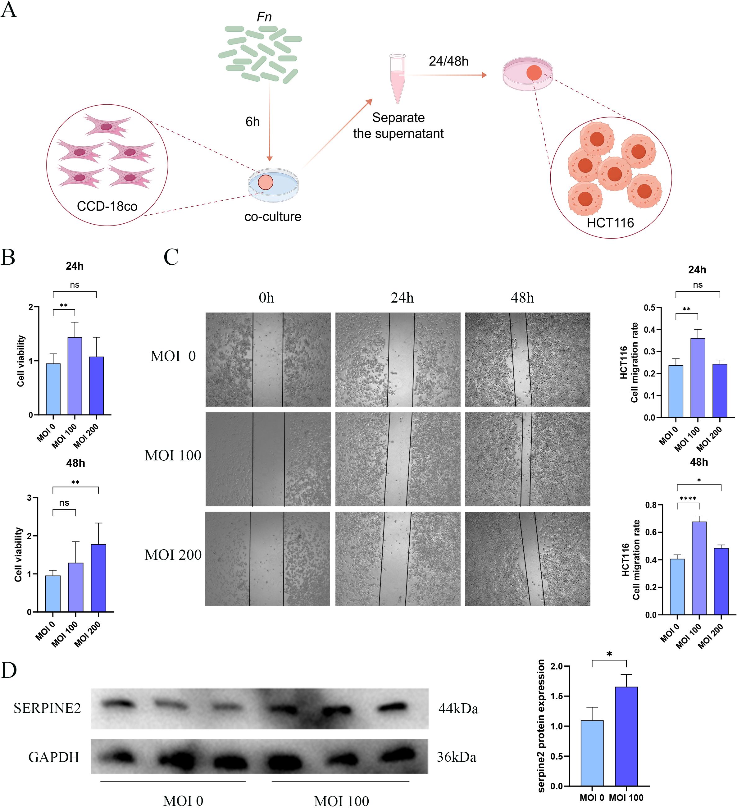 Diagram illustrating a study on cell interaction. Panel A: Experimental setup with CCD-18co and HCT116 cell co-culture, involving Fn treatment and supernatant separation at 24 or 48 hours. Panel B: Bar graphs showing cell viability at MOI (Multiplicity of Infection) levels 0, 100, and 200 with statistical significance indicated. Panel C: Images of HCT116 cell migration at 0, 24, and 48 hours, with accompanying migration rate bar graphs for different MOI levels. Panel D: Western blot images showing SERPINE2 and GAPDH protein expression with a bar graph indicating increased SERPINE2 expression at MOI 100.