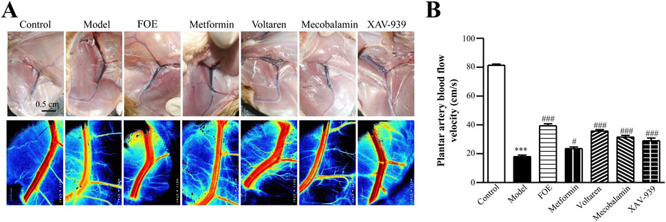 Panel A consists of six sets of images, each with a macroscopic view of arteries and a corresponding thermal map, labeled as Control, Model, FOE, Metformin, Voltaren, Mecobalamin, and XAV-939. Panel B is a bar chart showing plantar artery blood flow velocity in centimeters per second across the same groups, with the Model group showing significantly lower blood flow than others.