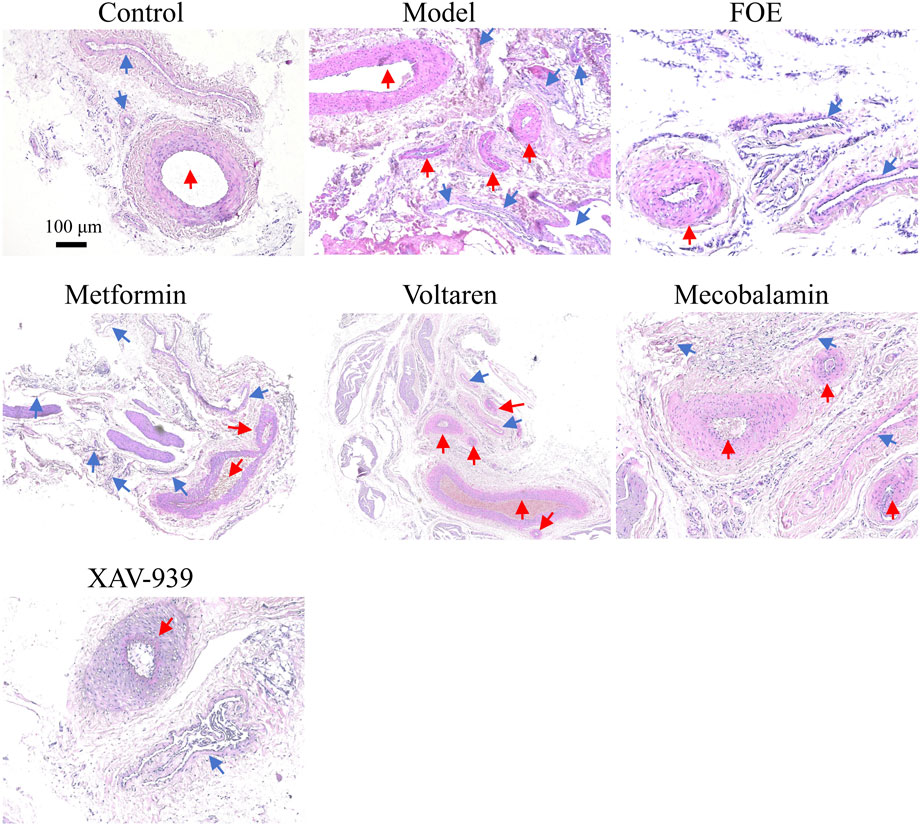 Histological images of tissue sections labeled with different treatments: Control, Model, FOE, Metformin, Voltaren, Mecobalamin, and XAV-939. Red and blue arrows indicate different cellular features, with varying tissue morphology evident across treatments. Scale bar shown at 100 micrometers.