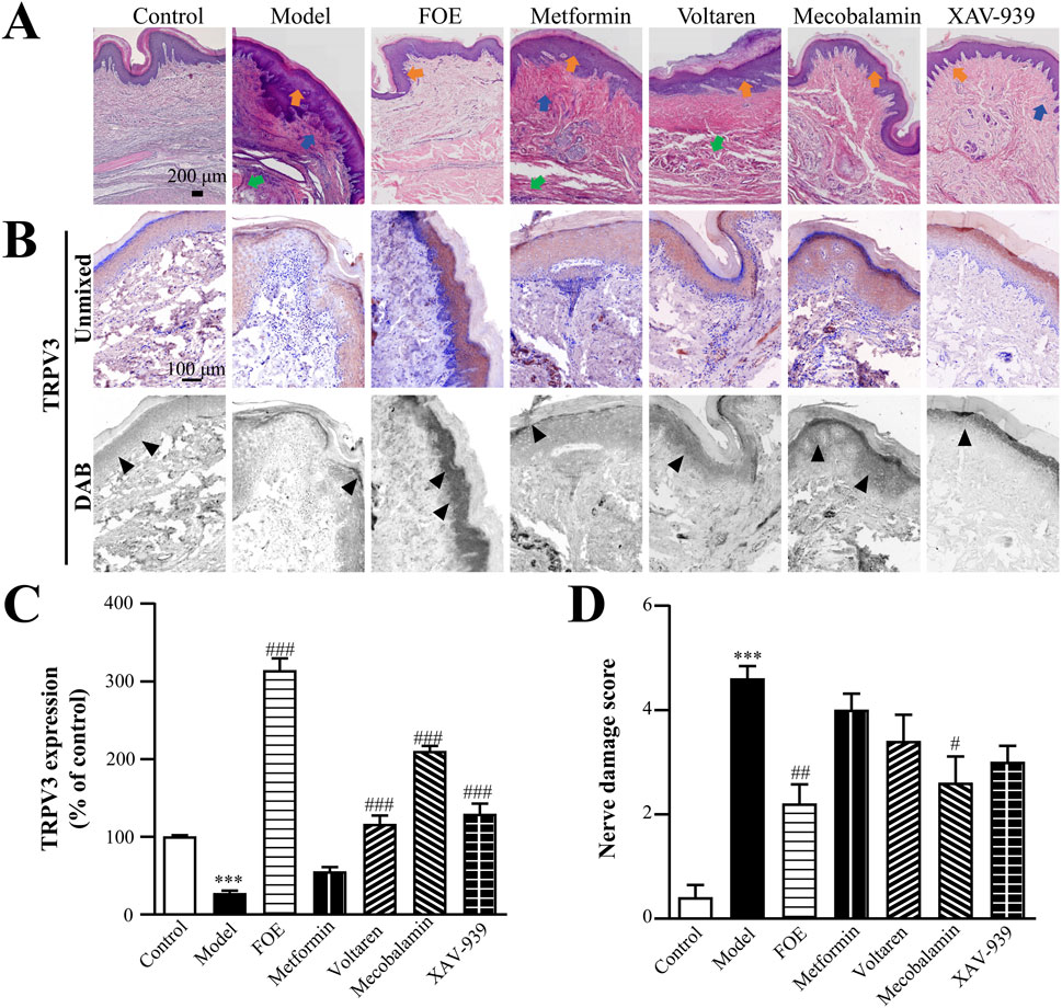 Panel A shows histological images comparing skin samples under different treatments, labeled Control, Model, FOE, Metformin, Voltaren, Mecobalamin, and XAV-939. Panel B displays corresponding TRPV3 and DAB staining. Panel C is a bar chart of TRPV3 expression as a percentage of control, showing varying levels across treatments. Panel D is a bar chart depicting nerve damage scores for each treatment.