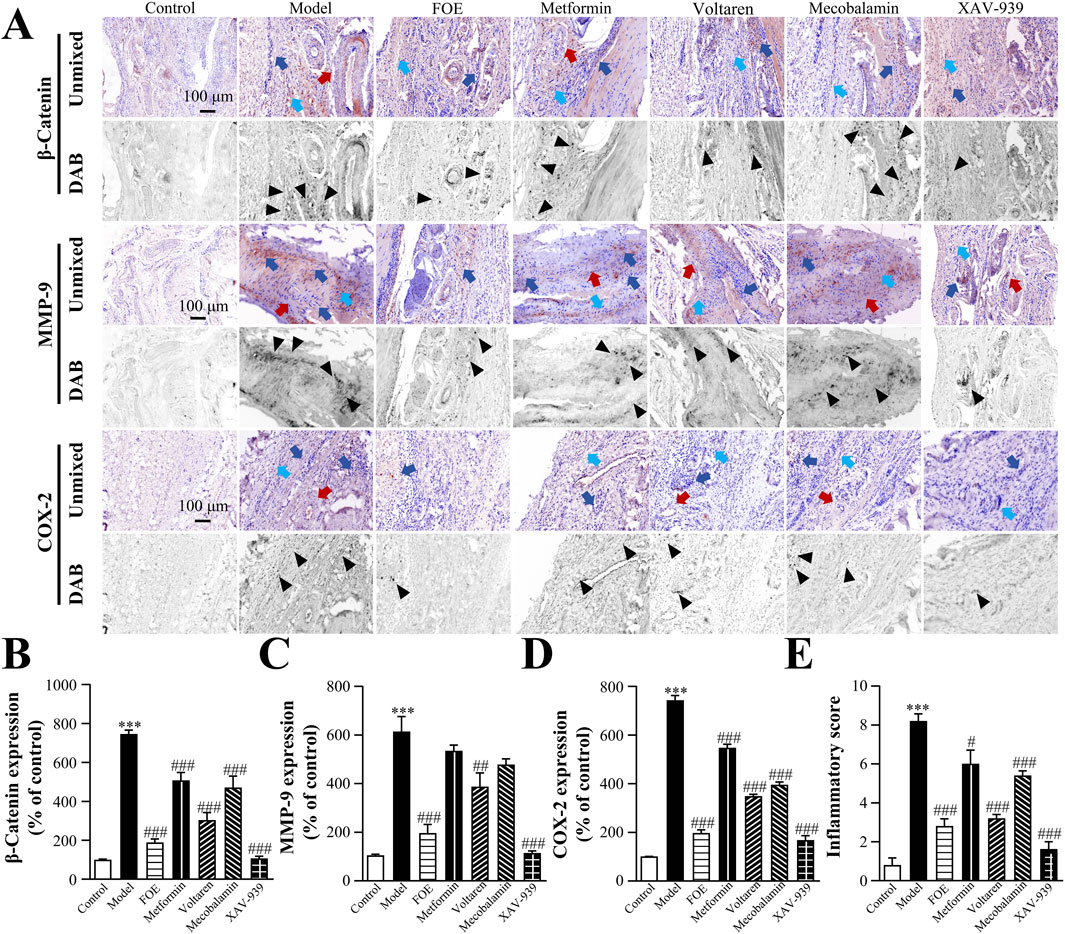 Panel A displays histological images stained for β-Catenin, MMP-9, and COX-2, comparing different treatments: Control, Model, FOE, Metformin, Voltaren, Mecobalamin, and XAV-939. Each set includes unmixed and DAB-stained images. Panels B to E are bar graphs showing the expression levels of β-Catenin, MMP-9, COX-2, and an inflammatory score across treatments, highlighting significant differences compared to the control and model groups.