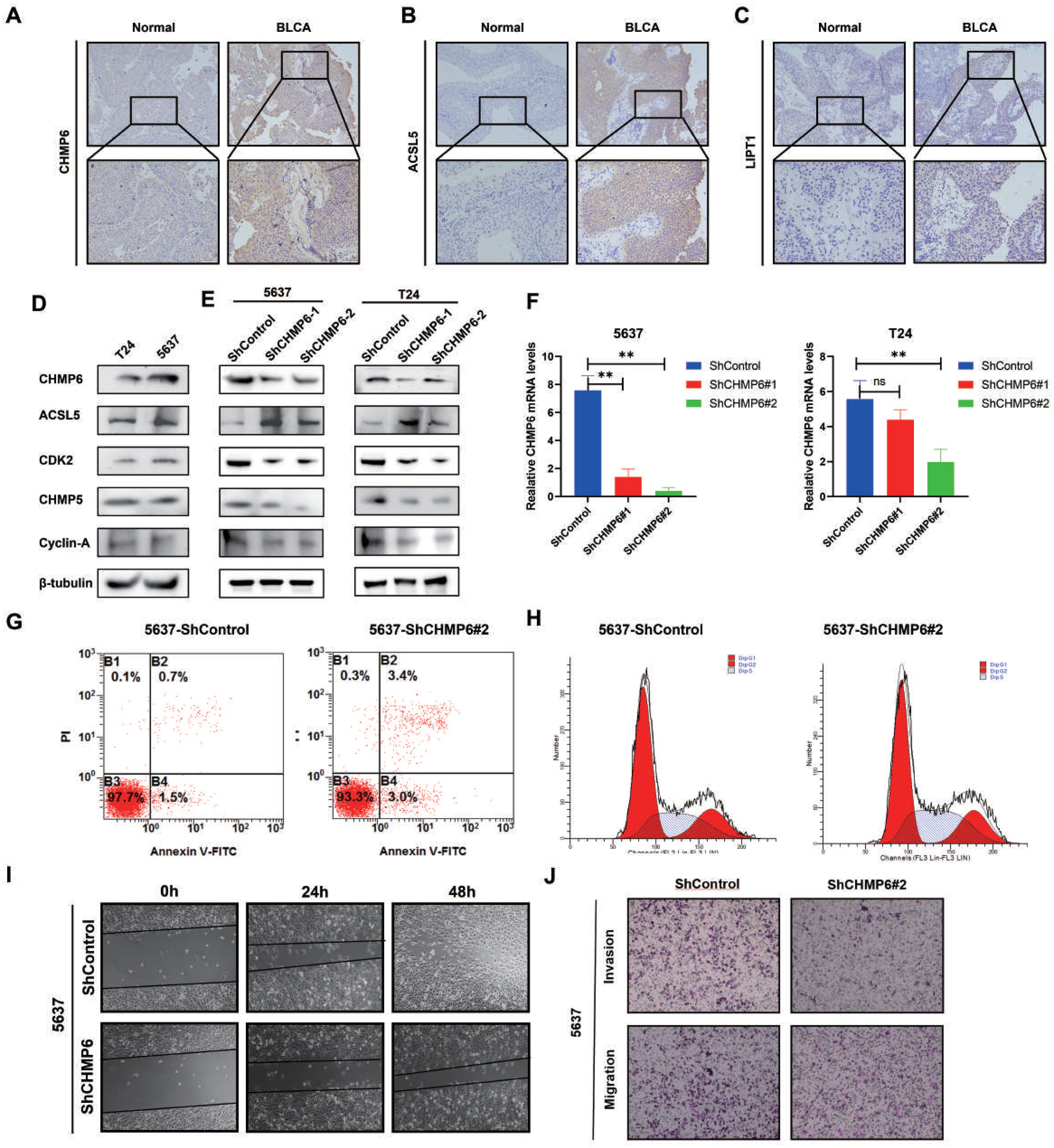 Panels showing various experiments related to cell lines and proteins in bladder cancer research. Panels A-C illustrate CHMP6, ACSL5, and LBP1 expression in normal vs. BLCA tissues, with magnified views. Panels D and E show Western blots of proteins in T24 and 5637 cell lines. Panel F presents mRNA level bar graphs for CHMP6 in different cell lines. Panel G includes flow cytometry plots for Annexin V-FITC and PI staining. Panel H shows cell cycle analysis histograms. Panel I depicts cell migration images over 0, 24, and 48 hours. Panel J features images of invasion and migration assays.