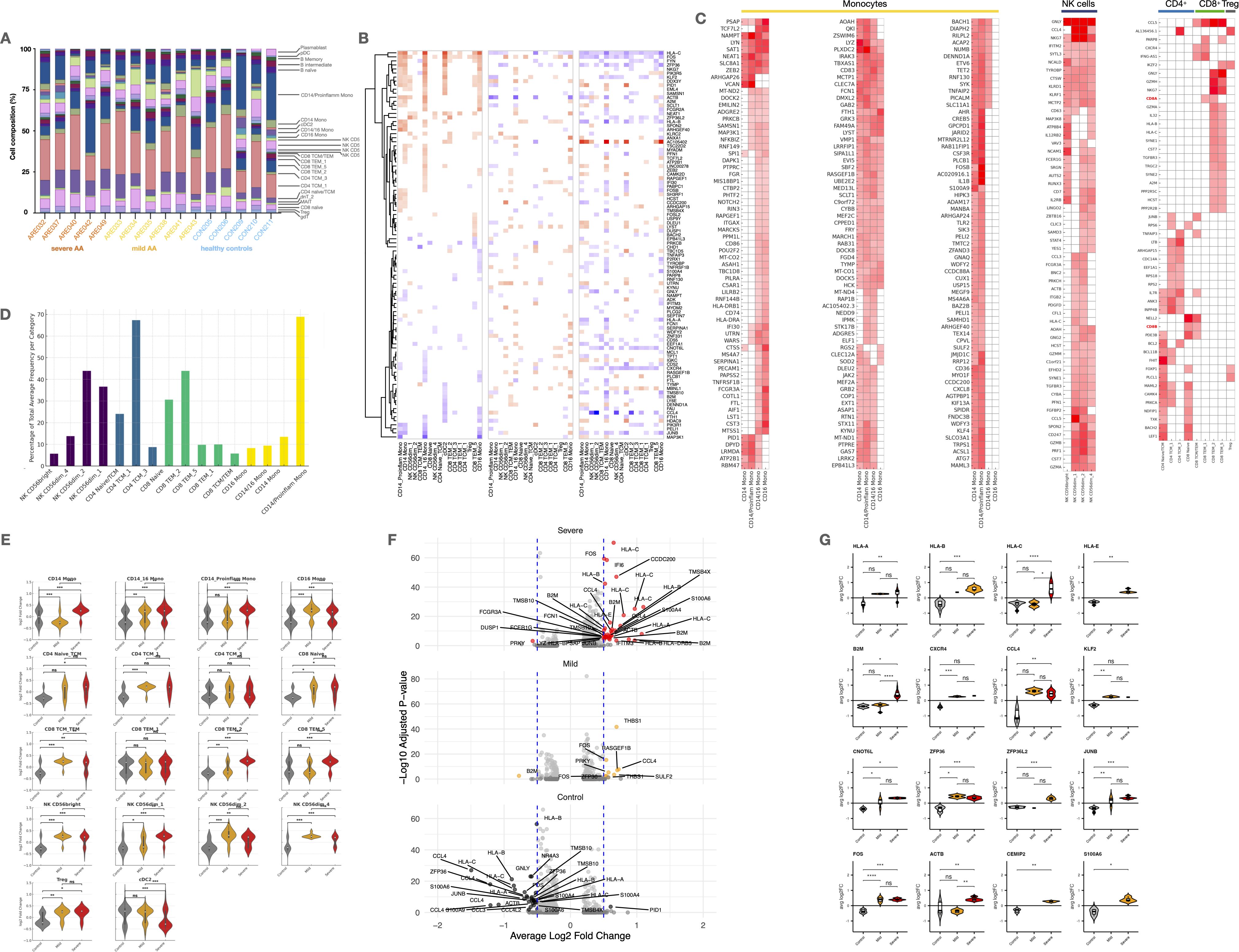 Multiple charts and graphs display data related to immune cell compositions and gene expressions in severe and mild AA (Alopecia Areata) and healthy controls. A stacked bar chart (A) shows cell composition percentages across groups. A heatmap (B) presents hierarchical clustering of gene expression data. Another heatmap (C) displays gene expressions in monocytes, NK cells, and T cells. A bar chart (D) illustrates the percentage of significantly changed genes by category. Violin plots (E) compare gene expression levels across groups. Volcano plots (F) highlight differentially expressed genes. Additional violin plots (G) show individual gene expressions.