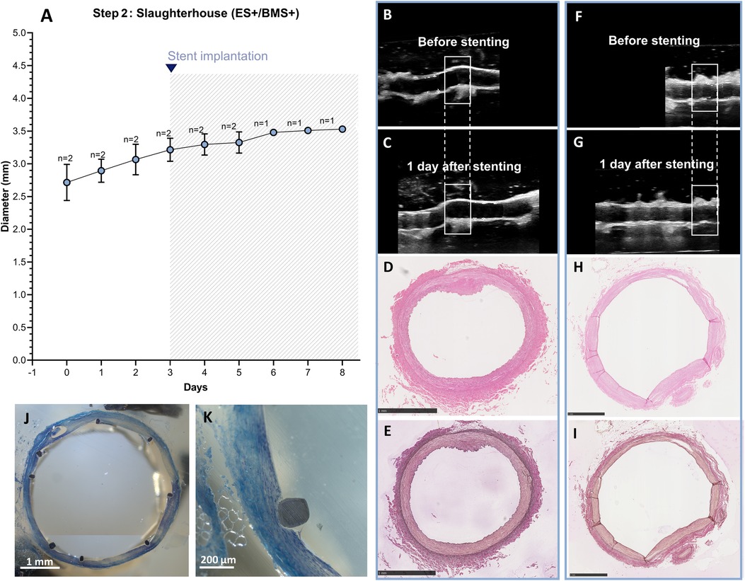 Composite image displaying scientific data related to stent implantation. Graph (A) shows diameter over days post-stent implantation. Ultrasound images (B, C) show arteries before and after stenting. Histological images (D, E, H, I) show cross-sections of arteries post-stenting. Images (F, G) show another ultrasound sequence before and after stenting. Images (J, K) display detailed views of stent structure, with magnification scales provided.