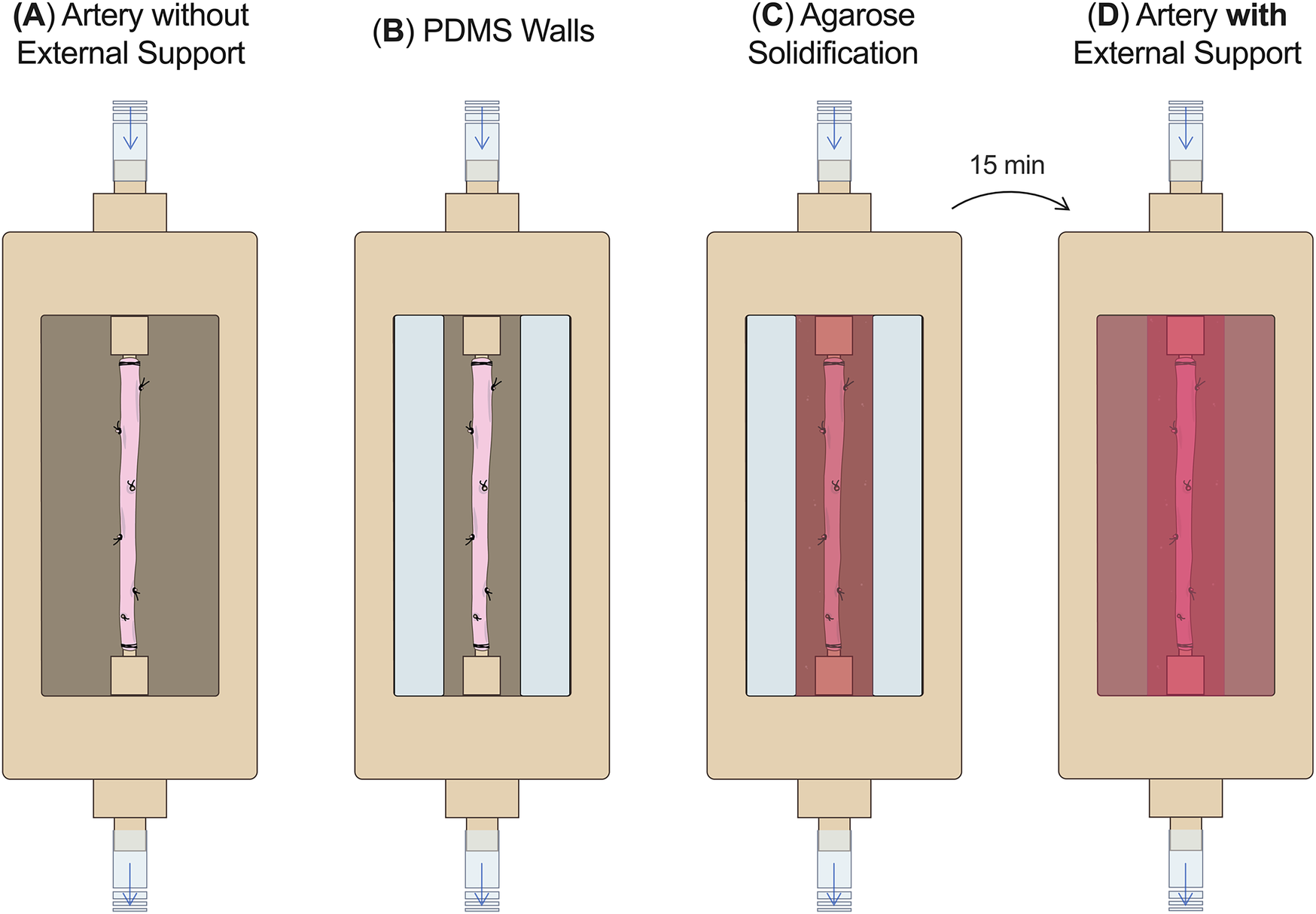 Diagram illustrating artery stabilization across four stages: (A) artery without support, (B) artery with PDMS walls, (C) agarose solidification around the artery, (D) artery with external support after 15 minutes. Each stage shows different containment and support structures.