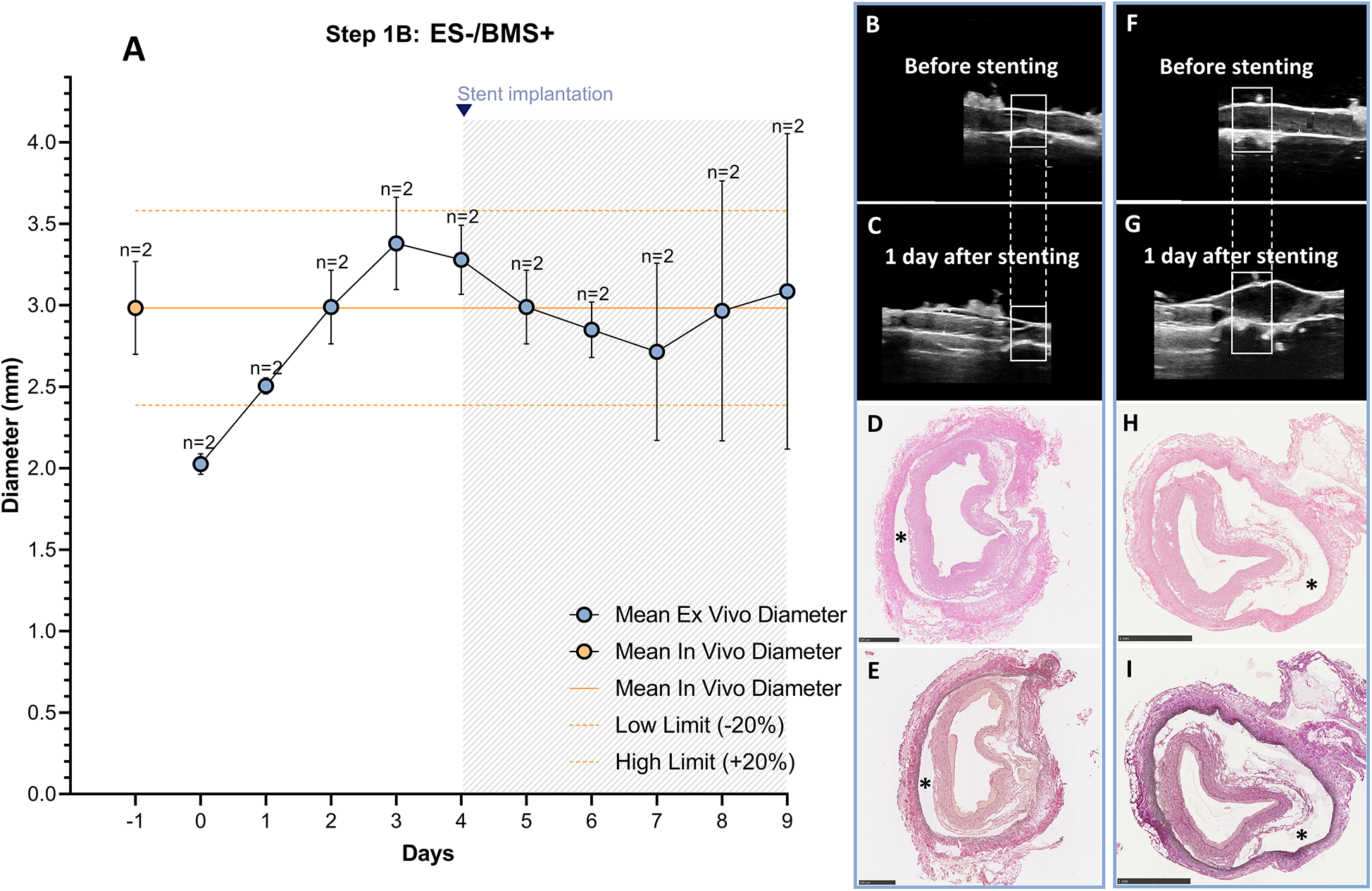 Graph A shows the change in diameter over ten days after stent implantation, with measured ex vivo and in vivo diameters. Images B, C, F, and G depict ultrasound scans before and after stenting. Images D, E, H, and I are histological cross-sections of vessels, marked with asterisks, illustrating the effects post-stenting.