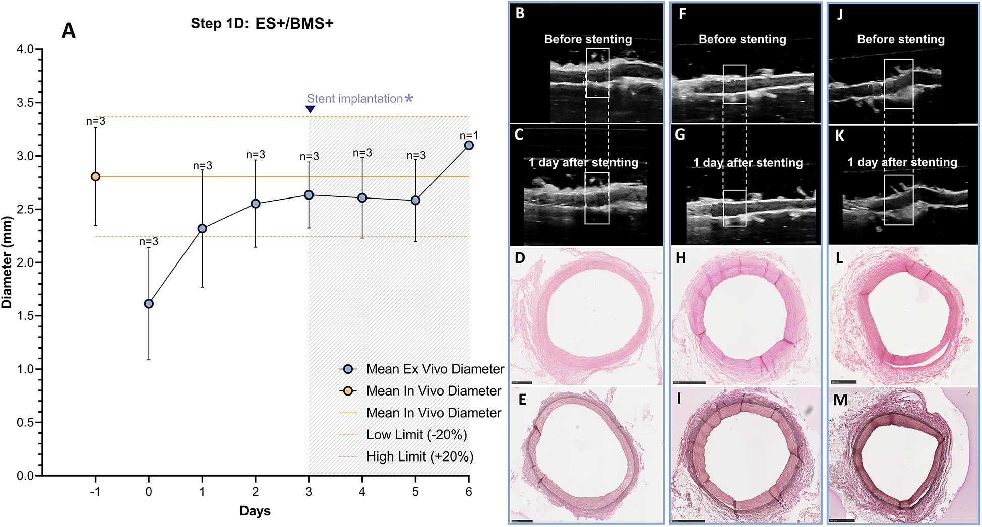 A multi-part image showing graphs and ultrasound scans related to stenting procedures. Part A displays a line graph of diameter versus days, indicating changes before and after stent implantation, with variation in ex vivo and in vivo measurements. Parts B and C, F and G, J and K are ultrasound images showing a vessel before and one day after stenting. Parts D, E, H, I, L, M are cross-sectional images of the vessels demonstrating structural changes post-stenting. The images collectively illustrate the physical impact of stenting on vessel diameter and structure over time.