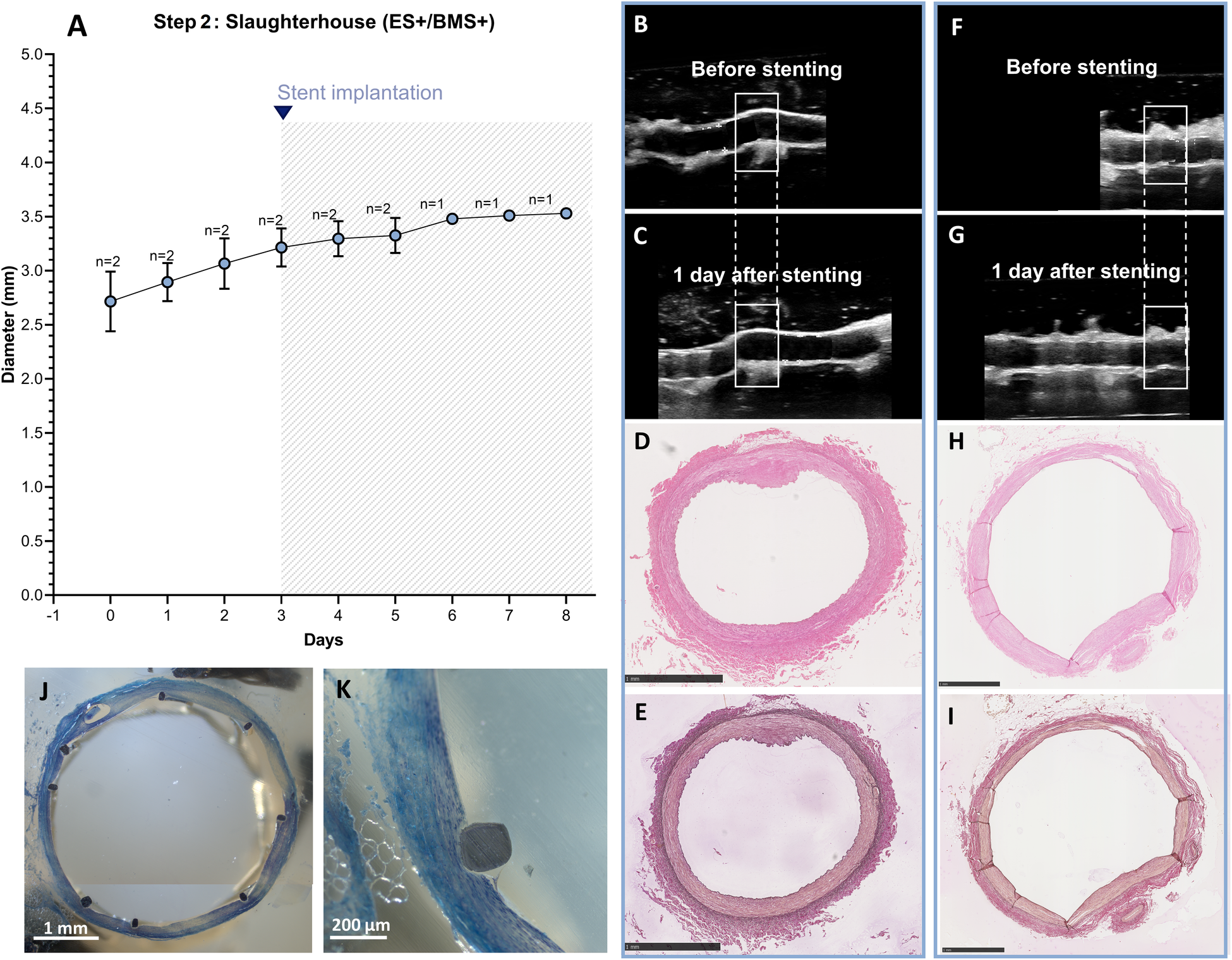 Composite image displaying scientific data related to stent implantation. Graph (A) shows diameter over days post-stent implantation. Ultrasound images (B, C) show arteries before and after stenting. Histological images (D, E, H, I) show cross-sections of arteries post-stenting. Images (F, G) show another ultrasound sequence before and after stenting. Images (J, K) display detailed views of stent structure, with magnification scales provided.