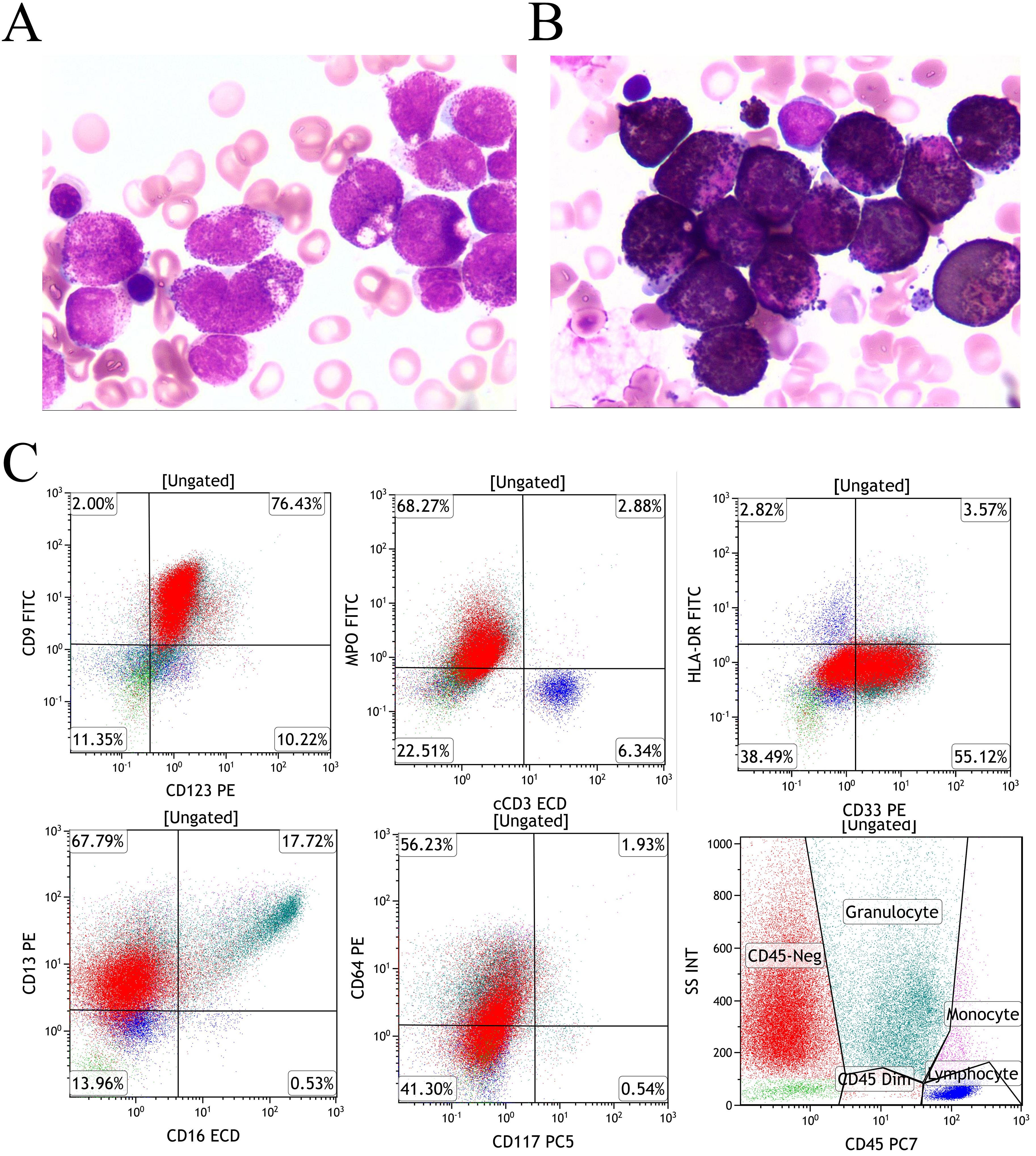 Panel A and B show microscopic images of blood cells stained in purple and pink hues, highlighting different cellular structures. Panel C features six flow cytometry scatter plots, each displaying data points in varying colors, indicating different cell markers with related percentages. The axes and percentages denote specific protein expressions measured during the analysis process.