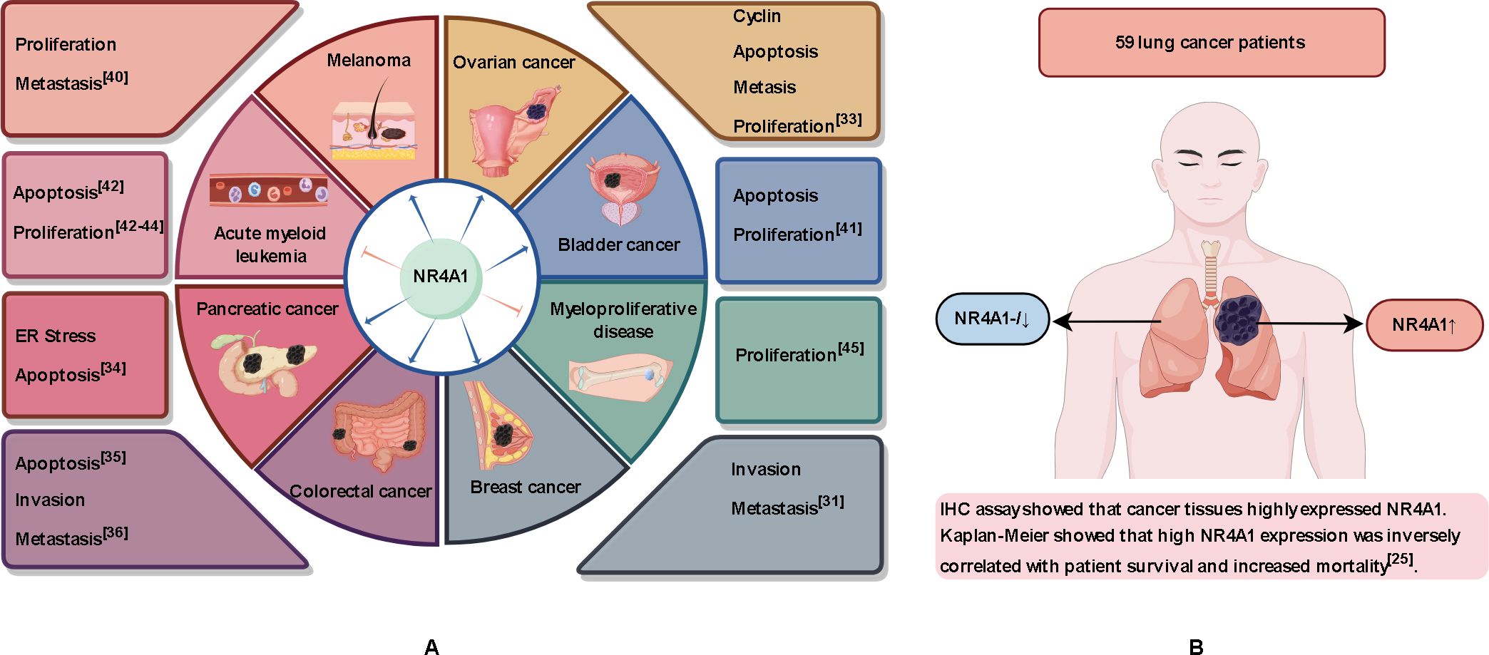 Diagram illustrating the role of NR4A1 in various cancers. Panel A shows NR4A1's involvement in melanoma, ovarian, bladder, pancreatic, colorectal, and breast cancers, along with acute myeloid leukemia and myeloproliferative disease, linked to proliferation, metastasis, apoptosis, ER stress, and invasion. Panel B depicts a person with lung cancer, noting the correlation between high NR4A1 expression and increased mortality in 59 patients. Kaplan-Meier analysis indicates that high NR4A1 expression is inversely related to patient survival.