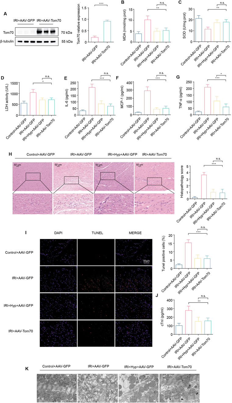 Graphs and panels show the impact of AAV-GFP and AAV-Tom70 treatments under ischemia-reperfusion conditions. Western blot analysis (A) shows higher Tom70 expression with AAV-Tom70. Bar graphs (B-G, J) illustrate varying levels of biochemical markers such as MDA, SOD, LDH activity, IL-6, MCP-1, TNF-α, and cTnI across different groups, with significant differences indicated by asterisks. Panel H presents histopathological images and scores, highlighting tissue changes. Panel I depicts DAPI, TUNEL, and merged images of cell apoptosis in different treatments, while panel K shows ultrastructural changes in cells. Statistical comparisons are noted as significant or not significant.