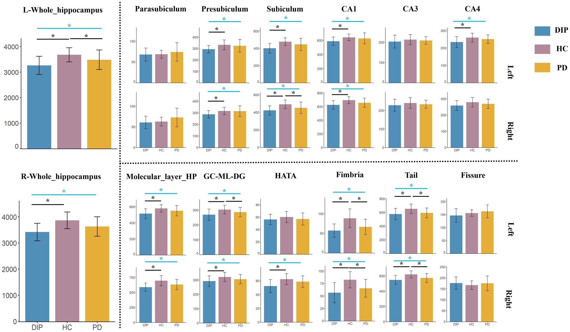 Bar charts comparing brain region volumes across three groups: DIP, HC, and PD. Separate charts for left and right hemispheres include whole hippocampus, parahippocampal regions, and molecular layers. Significant differences are indicated by asterisks, showing variations in regional brain volumes among the groups. Color-coded legend on the right helps distinguish groups.