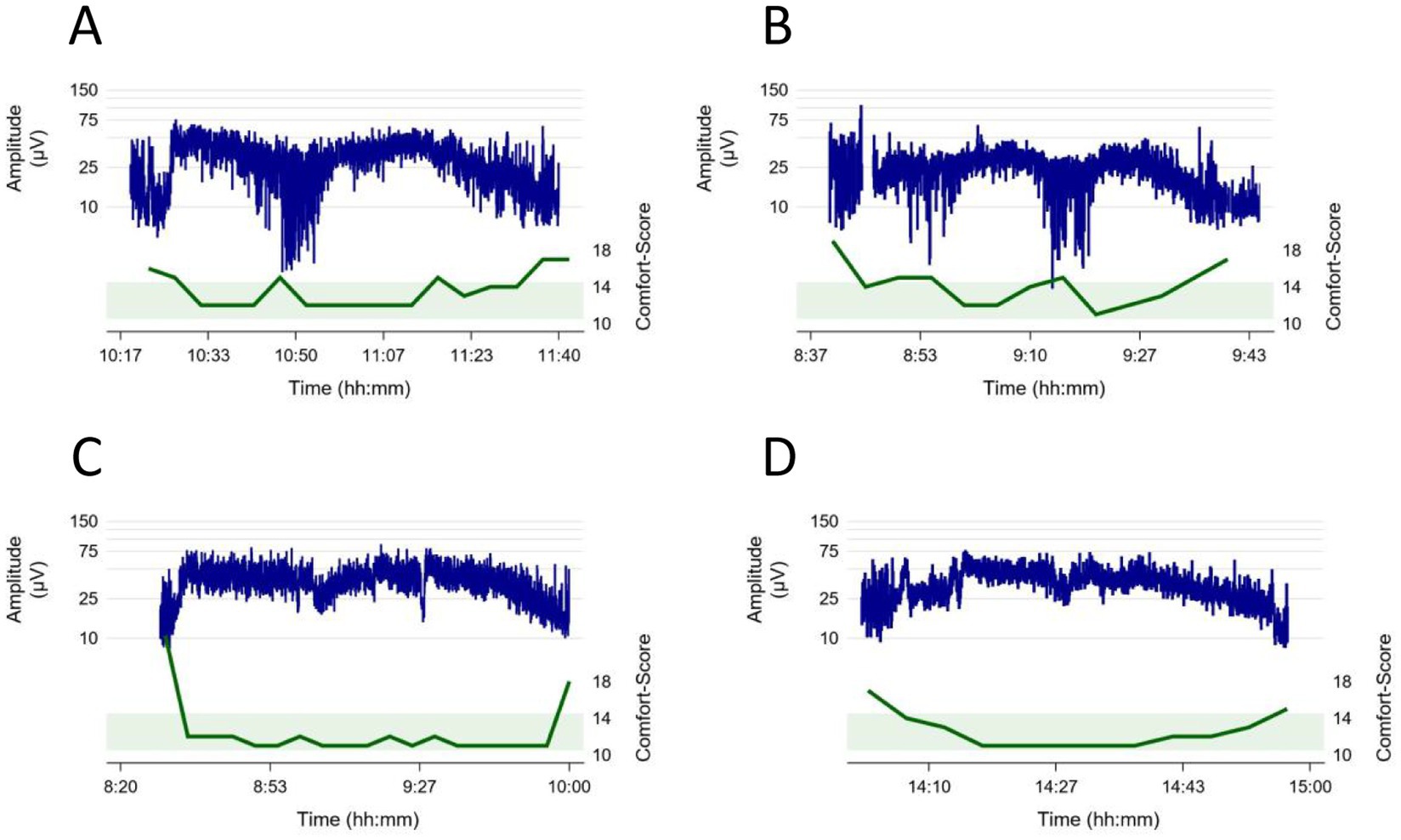 Four line graphs labeled A, B, C, and D display amplitude in microvolt in different patients over time in hours and minutes. Each graph shows blue amplitude fluctuations and a green comfort score line. Comfort scores varying between 10 and 18.