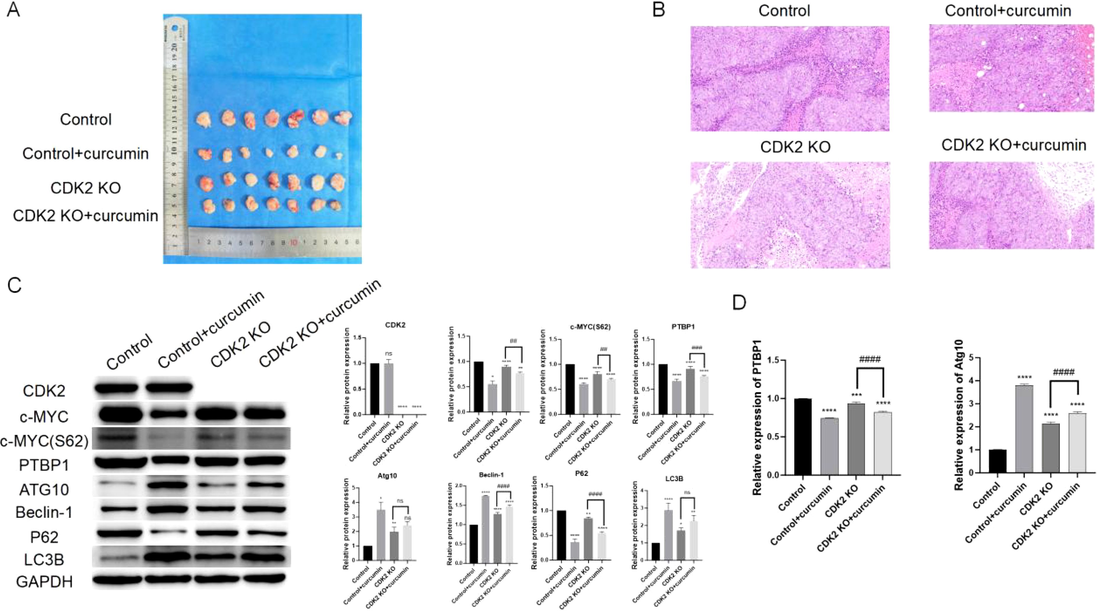 Frontiers | Curcumin inhibits colorectal cancer progression