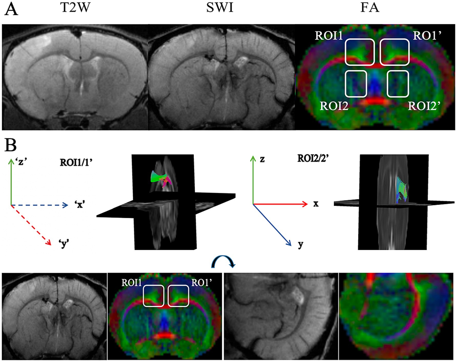 MRI brain images are shown in panels A and B. Panel A displays three different types of scans: T2-weighted (T2W), susceptibility-weighted imaging (SWI), and fractional anisotropy (FA) with labeled regions of interest (ROI1, ROI1', ROI2, ROI2'). Panel B illustrates orientation axes (x, y, z) with images highlighting specific ROIs, including graphical representations of these orientations and ROIs on FA scans.