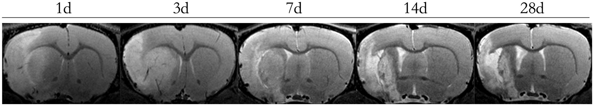 MRI scans showing brain images taken at intervals of one day, three days, seven days, fourteen days, and twenty-eight days. Differences in tissue appearance may indicate changes over time.