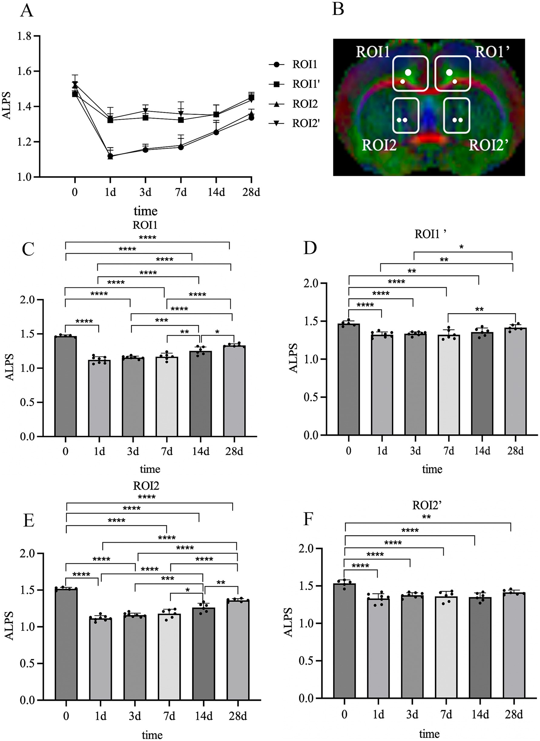 A series of graphs labeled A to F showing changes in ALPS values over time in two regions: ROI1 and ROI2, with sub-categories denoted by primes. Graph A shows a line plot with time points from zero to twenty-eight days for four ROIs. Graph B illustrates a color-coded brain scan with four marked regions: ROI1, ROI1', ROI2, ROI2'. Graphs C to F display bar charts with comparisons of ALPS values at various time intervals, indicating significant differences marked by asterisks. Time intervals include zero, one, three, seven, fourteen, and twenty-eight days.