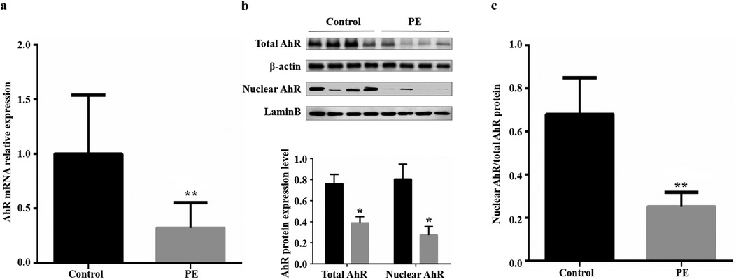 Bar and blot graphs showing AhR expression. Panel (a) compares AhR mRNA relative expression between Control and PE groups, showing a significant decrease in PE. Panel (b) shows Western blots for Total AhR, β-actin, Nuclear AhR, and LaminB, with quantitative bar graph below. Panel (c) compares Nuclear AhR/Total AhR protein ratios, indicating a decrease in the PE group. Asterisks denote statistical significance.