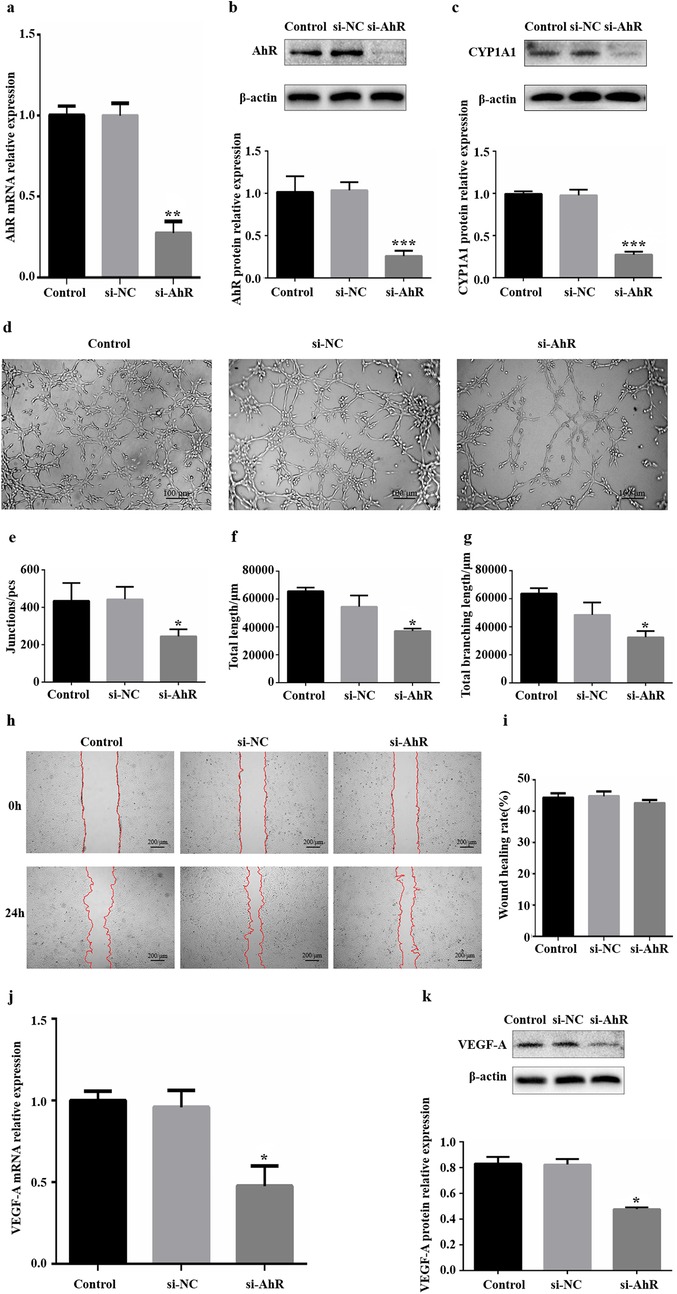 Bar graphs, microscopy images, and Western blot analyses illustrate the effects of AhR silencing on various parameters. Graphs (a, b, c) show reduced AHR and CYP1A1 expression in si-AhR samples. Microscopy images (d) display endothelial tube formation under different conditions. Bar graphs (e, f, g) compare junctions, total length, and branching length, showing a decrease in si-AhR samples. Wound healing images (h) depict scratch assays at zero and twenty-four hours. Bar graph (i) indicates wound healing rates. Graphs (j, k) show reduced VEGF-A expression at mRNA and protein levels in si-AhR samples.