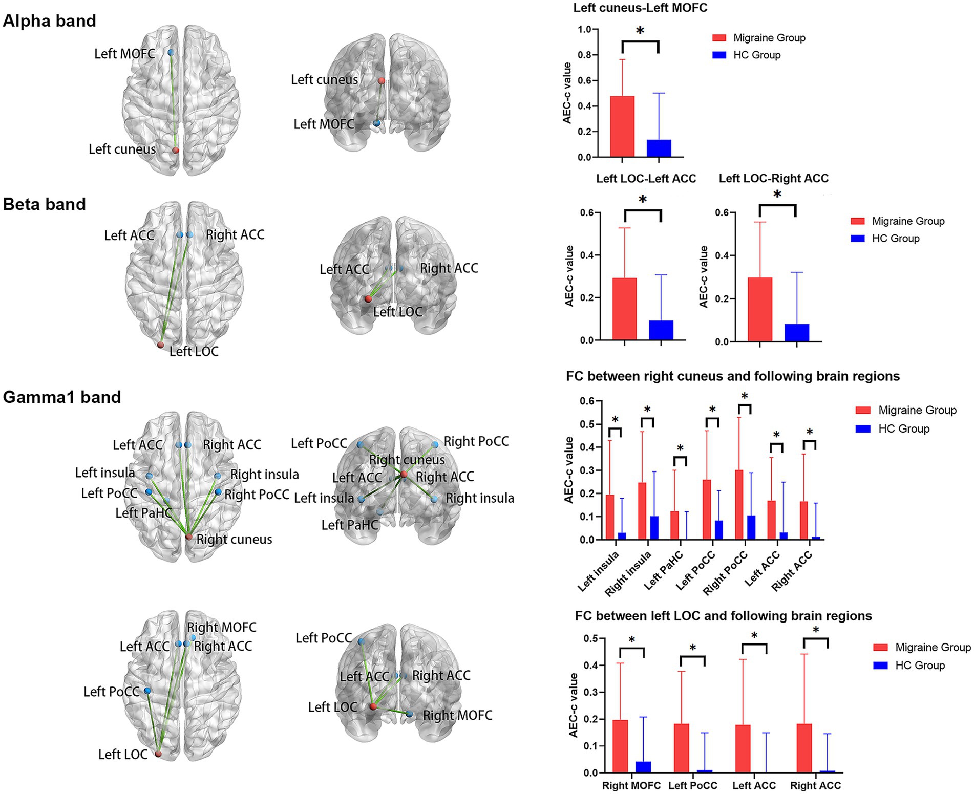 Brain connectivity analysis displayed through diagrams of brain regions for alpha, beta, and gamma1 bands. Connectivity differences between migraine and healthy control groups are shown. Bar graphs depict AEC-c values comparing brain regions with significant differences marked by asterisks. Regions analyzed include left cuneus, left MOFC, left LOC, right cuneus, and various ACC and insula regions. The migraine group typically shows higher connectivity values than the healthy control group.