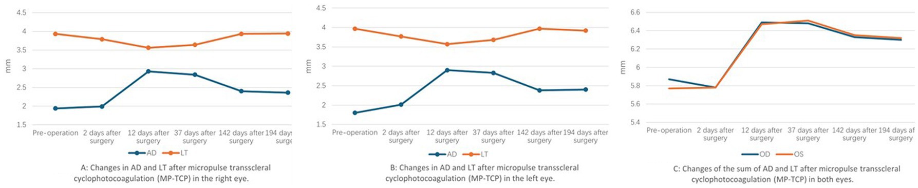 Three line graphs labeled A, B, and C compare measurements over time. Graph A shows LT decreasing slightly from 4 to around 3.8, while AD increases from 2 to 2.3, peaks at 3.1, and returns to 2.2 by 194 days. Graph B shows LT initially at 4, peaking at 4.5, then decreasing to 4.2, with AD starting at 3, peaking at 4, and slightly reducing to 3.6 by 194 days. Graph C displays OD and OS starting at 5.8, rising to 6.4 by day 12, and stabilizing around 6.2 afterward. Measurements are in millimeters.