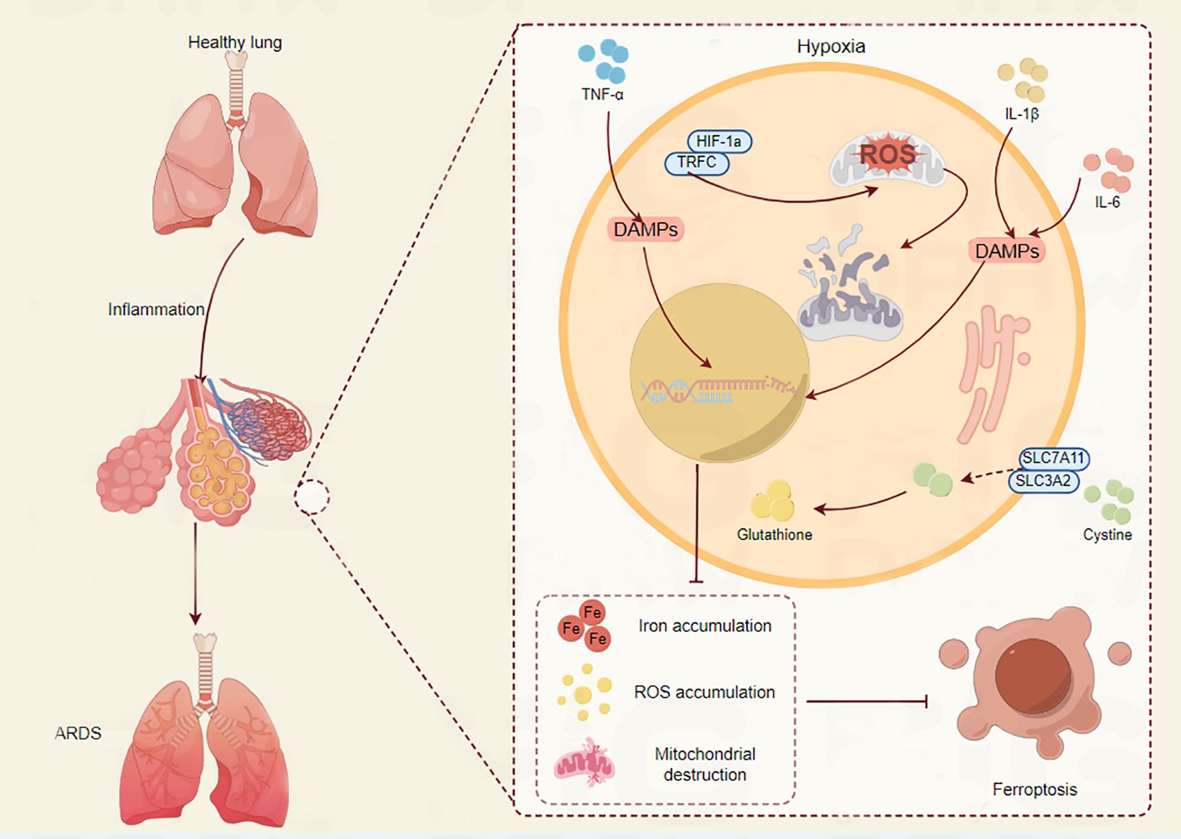 Diagram showing the progression from a healthy lung to one affected by acute respiratory distress syndrome (ARDS) through inflammation. The detailed inset illustrates cellular processes under hypoxia, including TNF-α, DAMPs, HIF-1a, TRFC, ROS, and IL-1β and IL-6. It highlights iron and ROS accumulation, mitochondrial destruction, and ferroptosis. Glutathione and cystine pathways are also depicted.