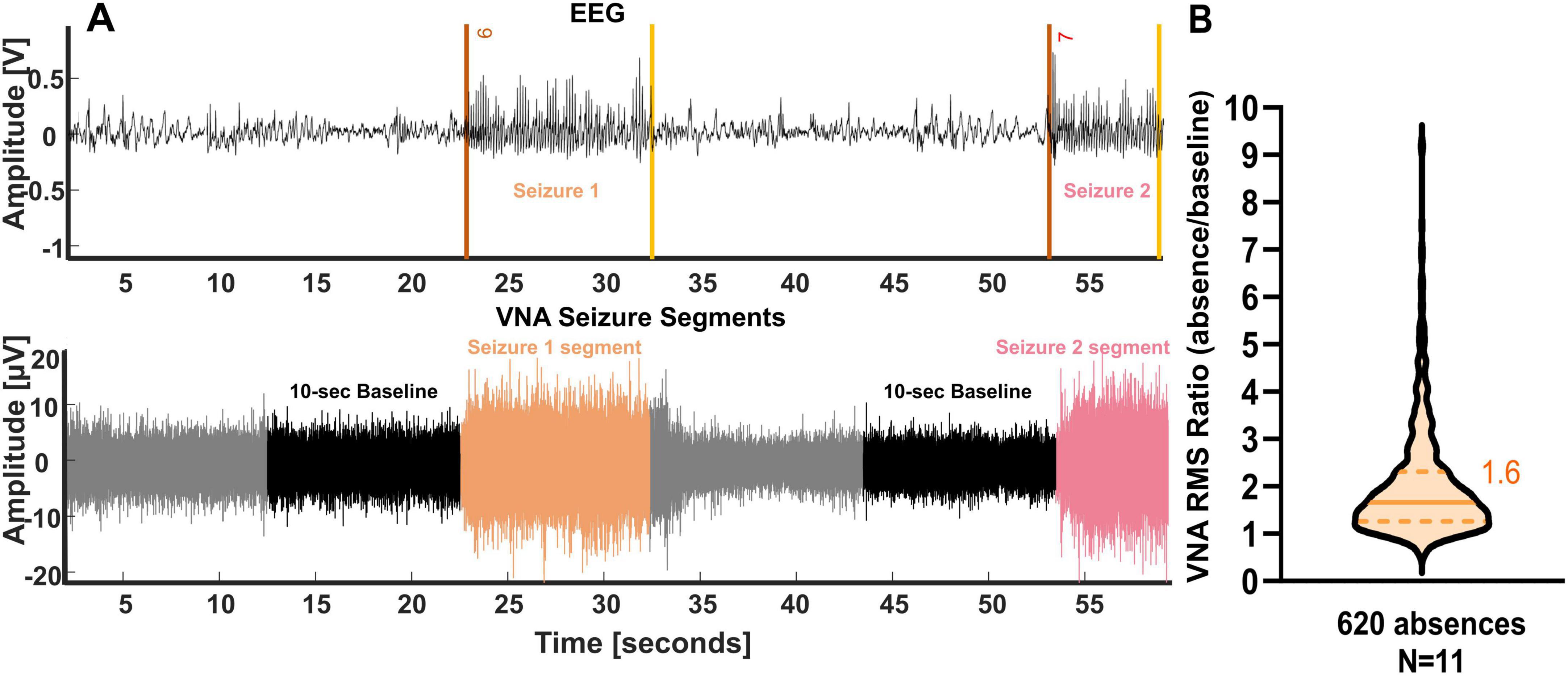Panel A displays two line graphs of EEG and VNA seizure segments, highlighting Seizure 1 and Seizure 2. The first graph shows amplitude over 60 seconds, with marked seizures. The second graph shows detailed VNA segments with baselines and seizures in orange and pink. Panel B presents a violin plot depicting the VNA RMS ratio of 620 absences across 11 samples, with a median value of 1.6.