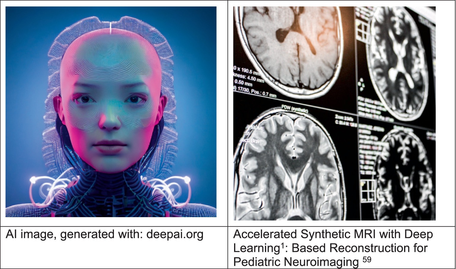 Composite image with two parts. Left: AI-generated portrait of a futuristic humanoid figure with neon elements and circuit-like facial texture, created using deepai.org. Right: Black-and-white MRI brain scans from a pediatric neuroimaging study, labeled with terms like “synthetic” and “PDW,” illustrating deep learning-based reconstruction in medical imaging.