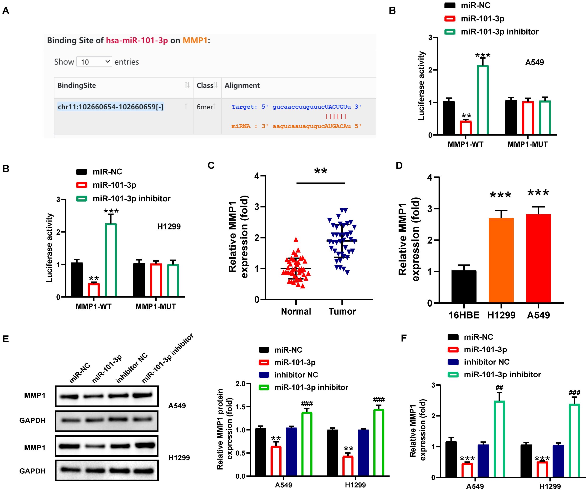 Data visualization of a study on the effects of hsa-miR-101-3p on MMP1 expression. Panel A shows the binding site alignment between hsa-miR-101-3p and MMP1. Panels B is bar graphs showing increased luciferase activity and MMP1 expression in tumor cells compared to normal cells. Panel C shows scatter plots contrasting MMP1 mRNA expression in normal versus tumor samples. Panel D is a bar graph indicating elevated MMP1 expression in H1299 and A549 cells. Panel E includes Western blots of MMP1 and GAPDH proteins, with bar graphs quantifying MMP1 protein expression in A549 and H1299 cells. Panel F details relative MMP1 expression in different treatments. Statistical significance is indicated by asterisks.