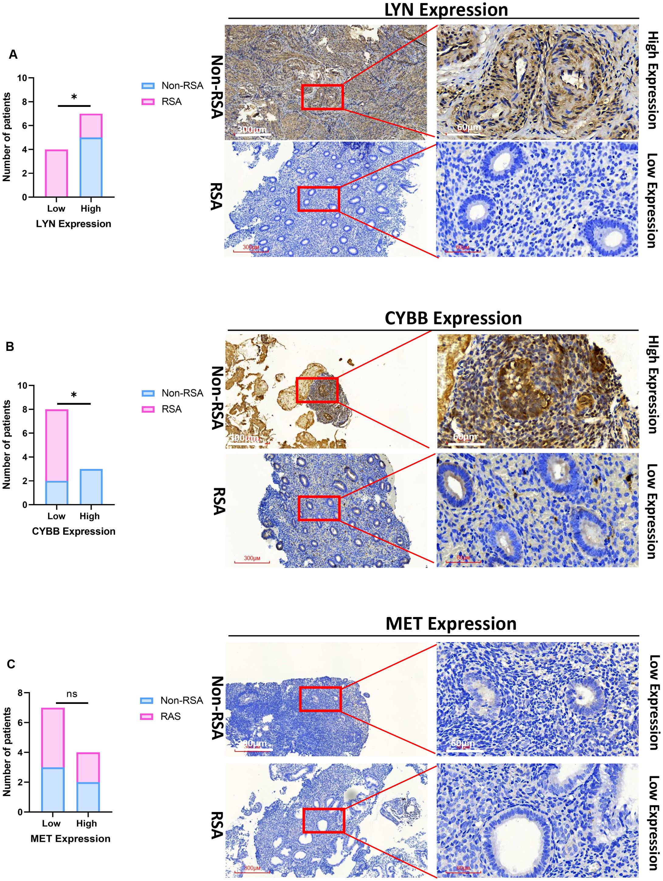 Bar graphs and microscopy images compare LYN, CYBB, and MET expression in Non-RSA and RSA patients. Each section has a bar graph indicating expression levels, followed by tissue samples with magnified views. Significant differences are noted for LYN and CYBB expression, while MET shows no significance. Enlarged areas highlight differing expression in tissues.