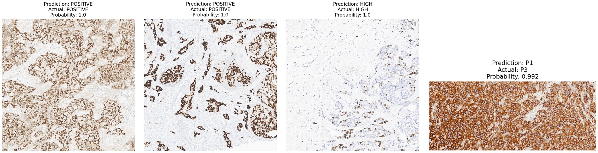 Four panels show different microscopy images with varying predictions and probabilities. The first two images have predictions and actual results labeled as