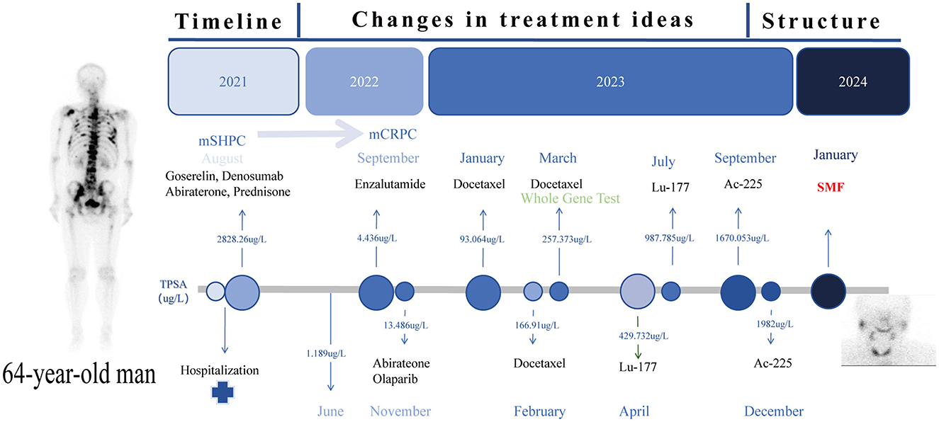Timeline showing a 64-year-old man's cancer treatment progression from 2021 to 2024. Key treatments include Goserelin, Enzalutamide, and Docetaxel. TPSA levels and hospitalization points are marked, indicating treatment phases with changes in medication and significant events. A skeleton image and a scan are included.