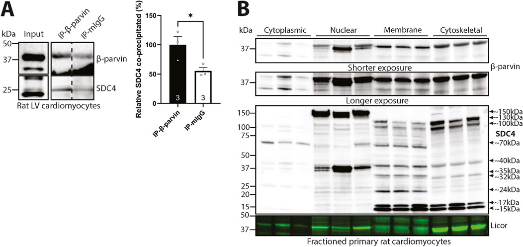 Panel A shows immunoprecipitation of β-parvin from rat left ventricular cardiomyocytes with a corresponding bar graph depicting relative SDC4 co-precipitation. Panel B displays Western blot results of β-parvin and syndecan-4 in cytoplasmic, nuclear, membrane, and cytoskeletal subcellular fractions.