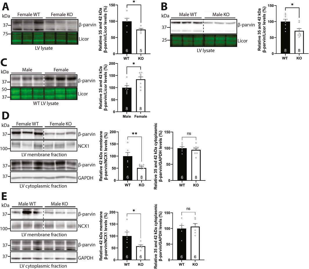 A series of five panels displaying Western blot analysis and corresponding bar graphs. Panels A and B compare β-parvin expression in wild-type (WT) and syndecan-4 knockout (KO) left ventricular lysates for female and male mice, showing significant differences. Panel C contrasts β-parvin levels between male and female WT mice. Panels D and E illustrate β-parvin expression in membrane and cytoplasmic fractions for female and male WT and KO mice, with significant changes noted in membrane fractions, but not in cytoplasmic fractions. Asterisks denote statistical significance.