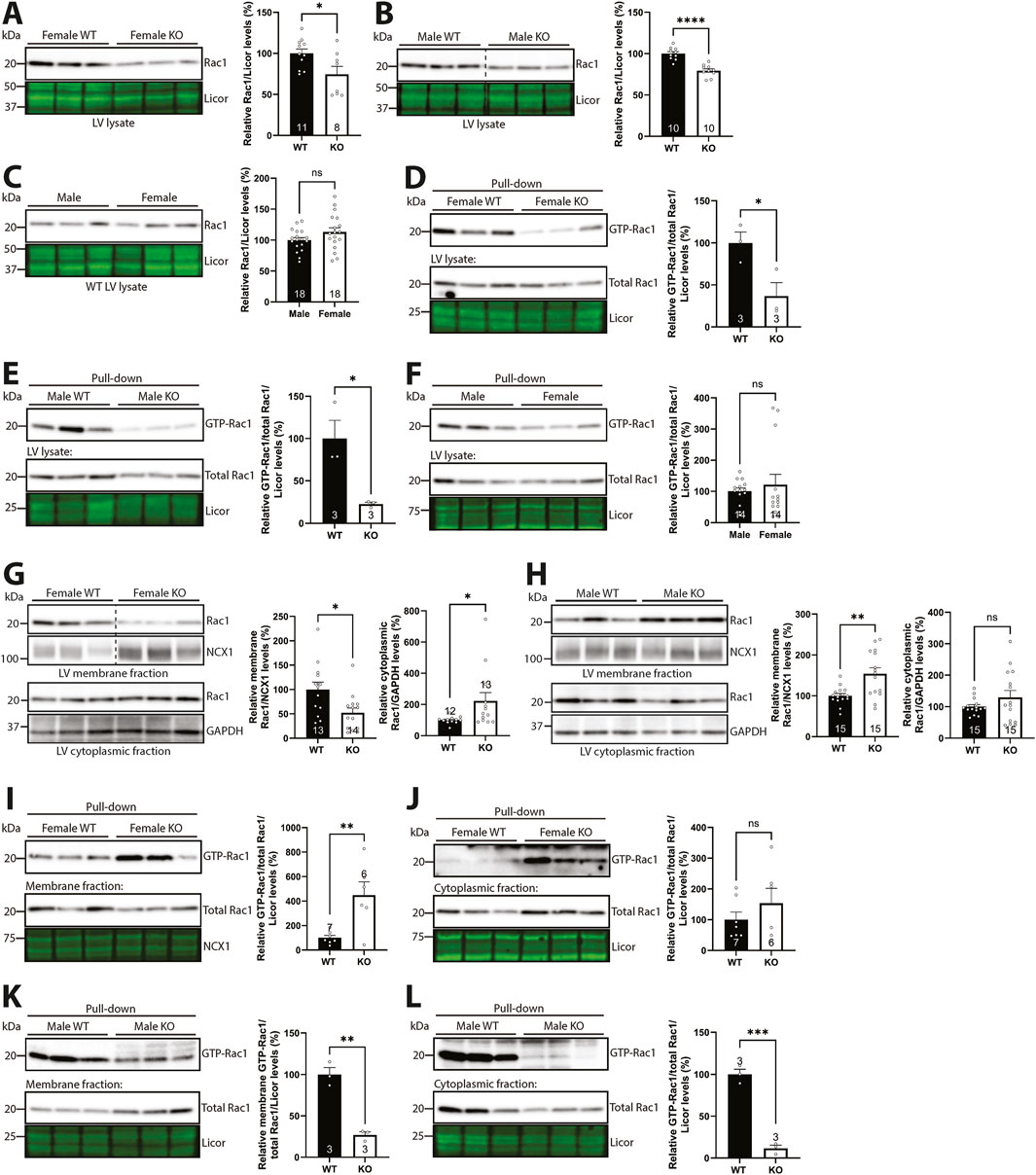 Western blot panels A to L show Rac1 protein levels, and active Rac1 pull-down assay results from left ventricular lysates across male and female wild-type (WT) and syndecan-4 knockout (KO) mice. Bar graphs illustrate significant differences, noted by asterisks.