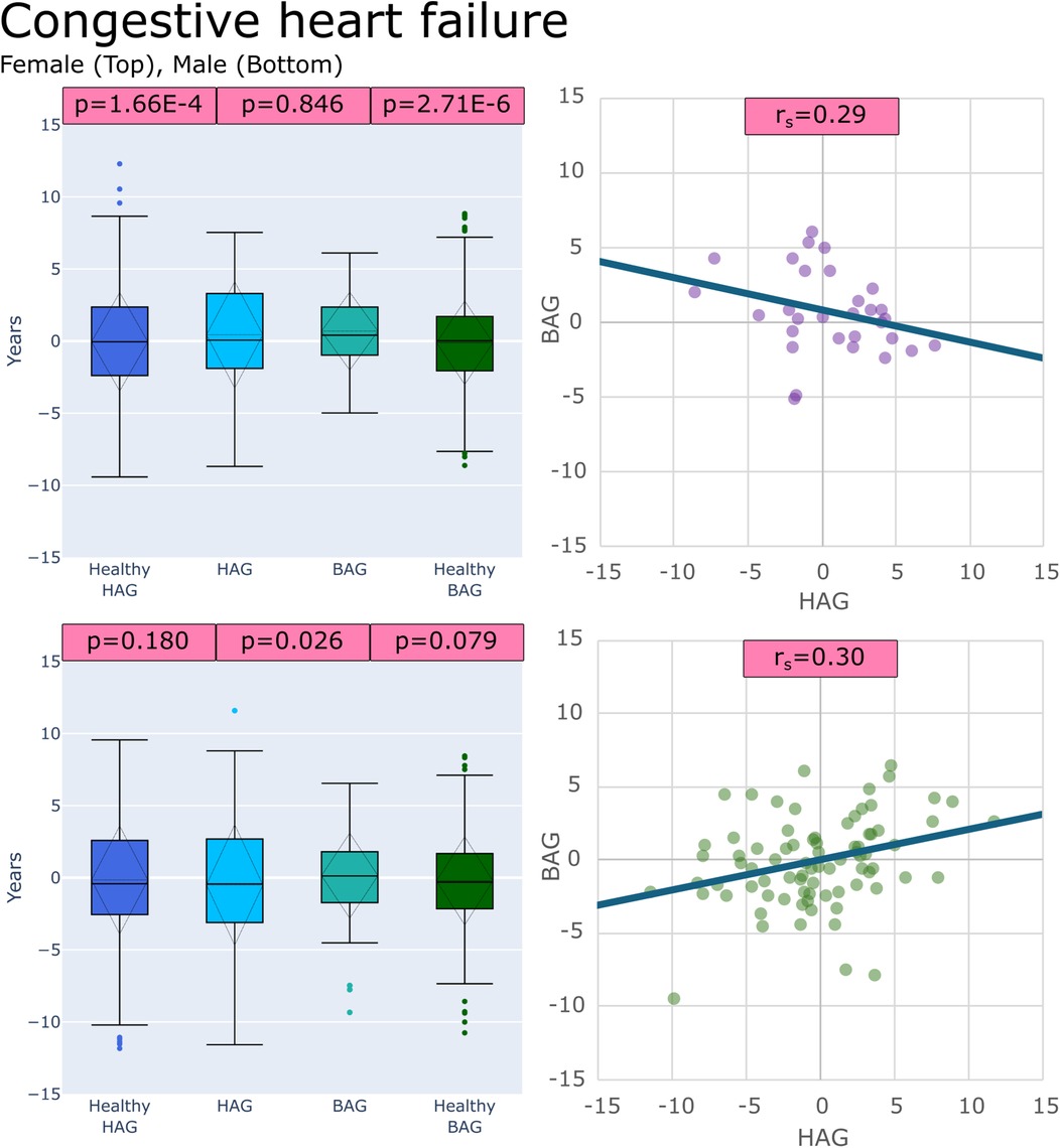 Box plots and scatter plots depicting congestive heart failure in males and females. The box plots compare Healthy HAG to HAG, HAG to BAG, and BAG to Healthy BAG groups. Female (p=1.66E-4, p=0.846, p=2.71E-6) respectively. Male (p=0.180, p=0.026, p=0.079) respectively. Scatter plots show negative correlation for females (rs=0.29) between HAG and BAG, while males show a positive correlation (rs=0.30).