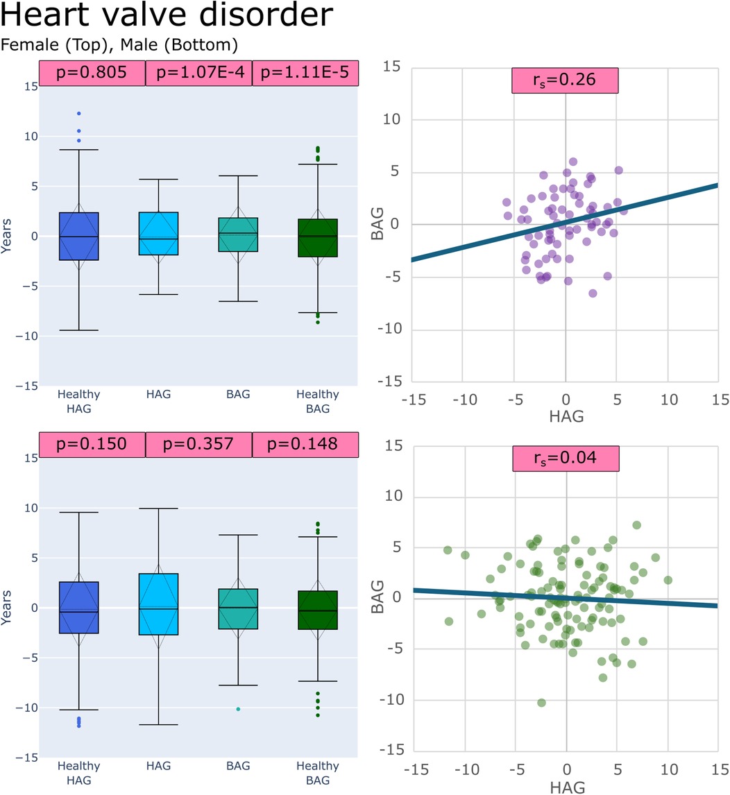 Box plots and scatter plots depicting heart valve disorder data in males and females. The box plots compare Healthy HAG to HAG, HAG to BAG, and BAG to Healthy BAG groups. Female (p=0.805, p=1.07E-4, p=1.11E-5) respectively. Male (p=0.150, p=0.357, p=0.148) respectively. Scatter plots show positive correlation for females (rs=0.26) between HAG and BAG, while males show a near zero correlation (rs=0.04).