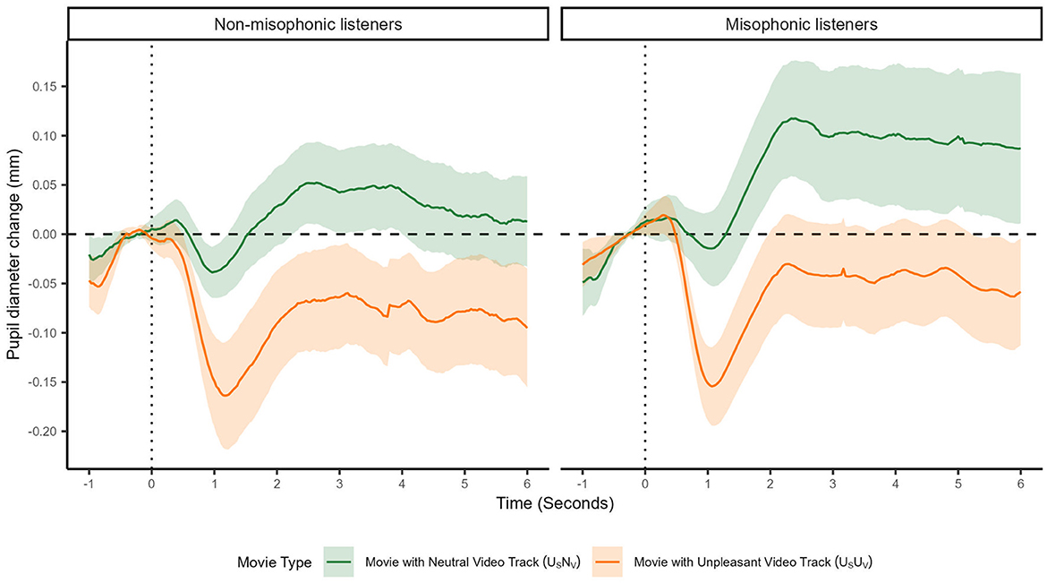 Line graphs compare pupil diameter changes over time between non-misophonic and misophonic listeners. The green line represents neutral video tracks, and the orange line represents unpleasant video tracks. Non-misophonic listeners and misophonic listeners exhibit notable changes, especially for unpleasant videos which constrict pupils. Both graphs display time in seconds on the x-axis and pupil diameter change in millimeters on the y-axis. Shaded areas indicate variability.