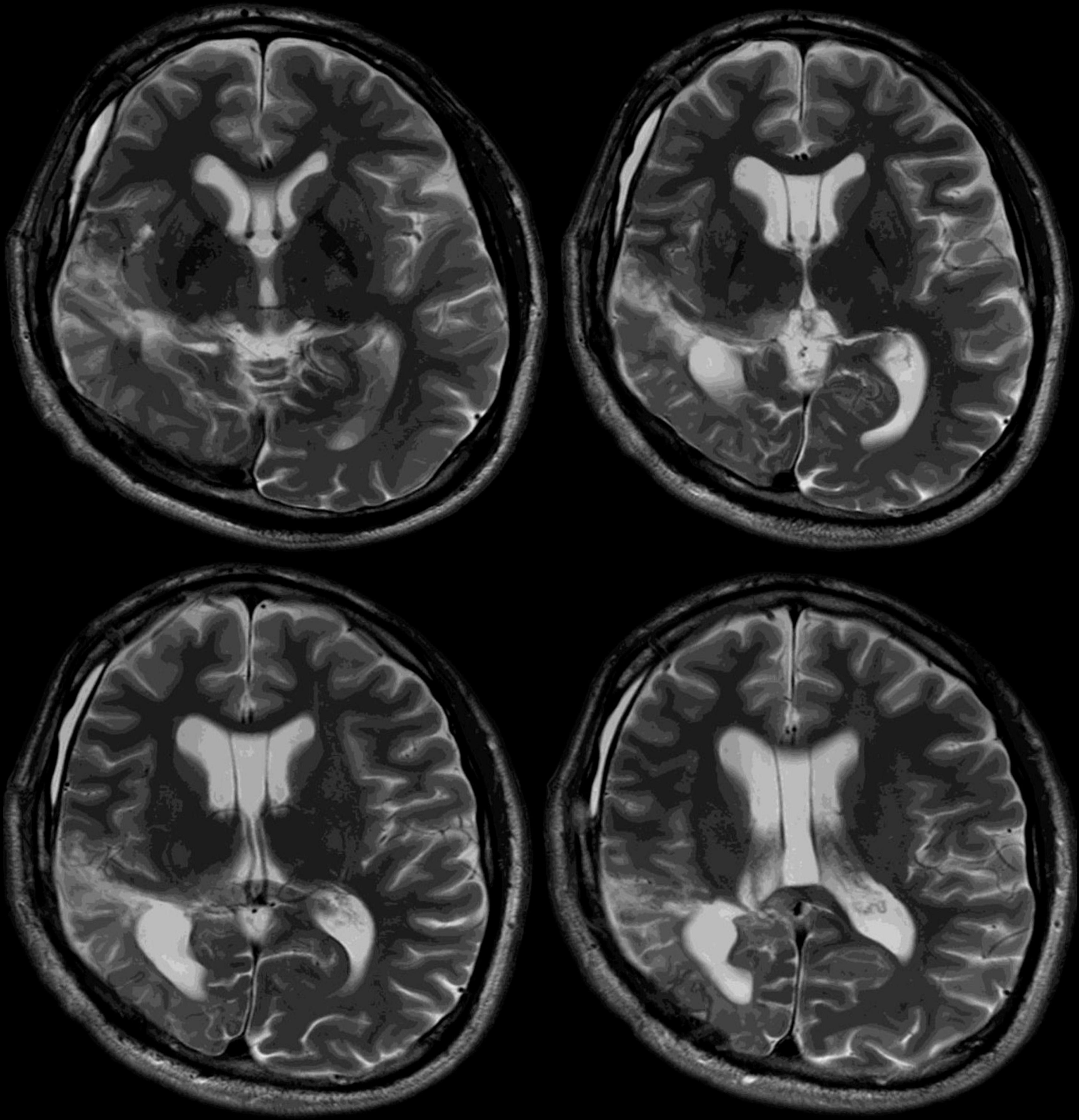 Frontiers | Evaluation of higher cognitive functions