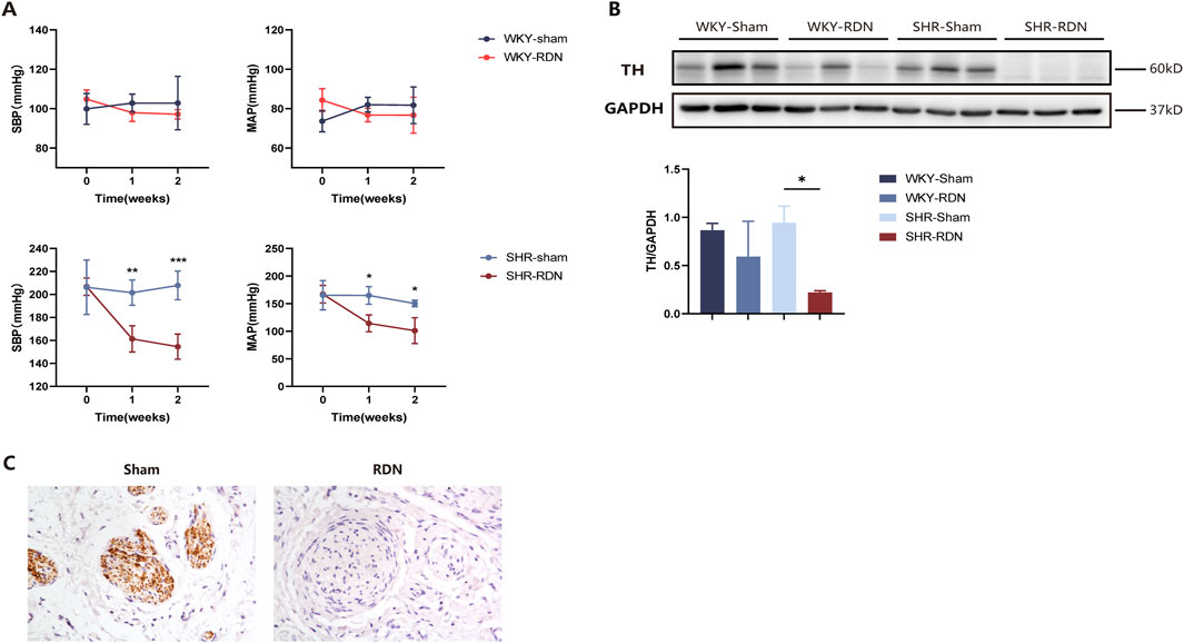 Panel A shows graphs of systolic and mean arterial pressure over two weeks for WKY and SHR groups, with RDN treatment showing a decrease in pressure. Panel B displays Western blot results for TH and GAPDH, with a bar graph indicating TH/GAPDH ratio differences across groups. Panel C shows histological images comparing sham and RDN treatments, highlighting tissue alterations.