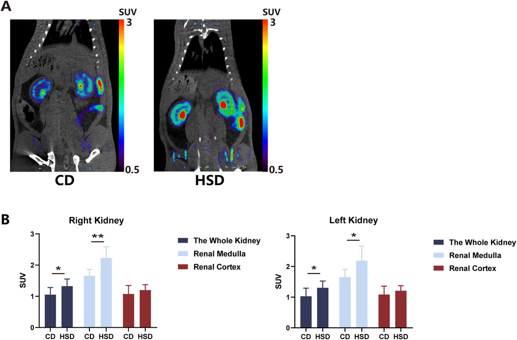 Panel A displays PET-CT scans comparing standard diet (CD) and high salt diet (HSD) in kidney sections, highlighting varying SUV levels. Panel B consists of bar graphs comparing SUV values for right and left kidneys under both diets, divided into whole kidney, renal medulla, and renal cortex. Statistical significance is marked with asterisks.