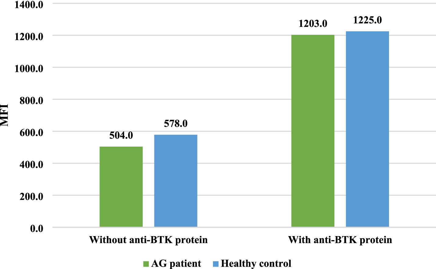 Bar graph comparing MFI levels in AG patients and healthy controls with and without anti-BTK protein. Without anti-BTK, AG patient MFI is 504.0, and healthy control is 578.0. With anti-BTK, AG patient MFI is 1203.0, and healthy control is 1225.0.